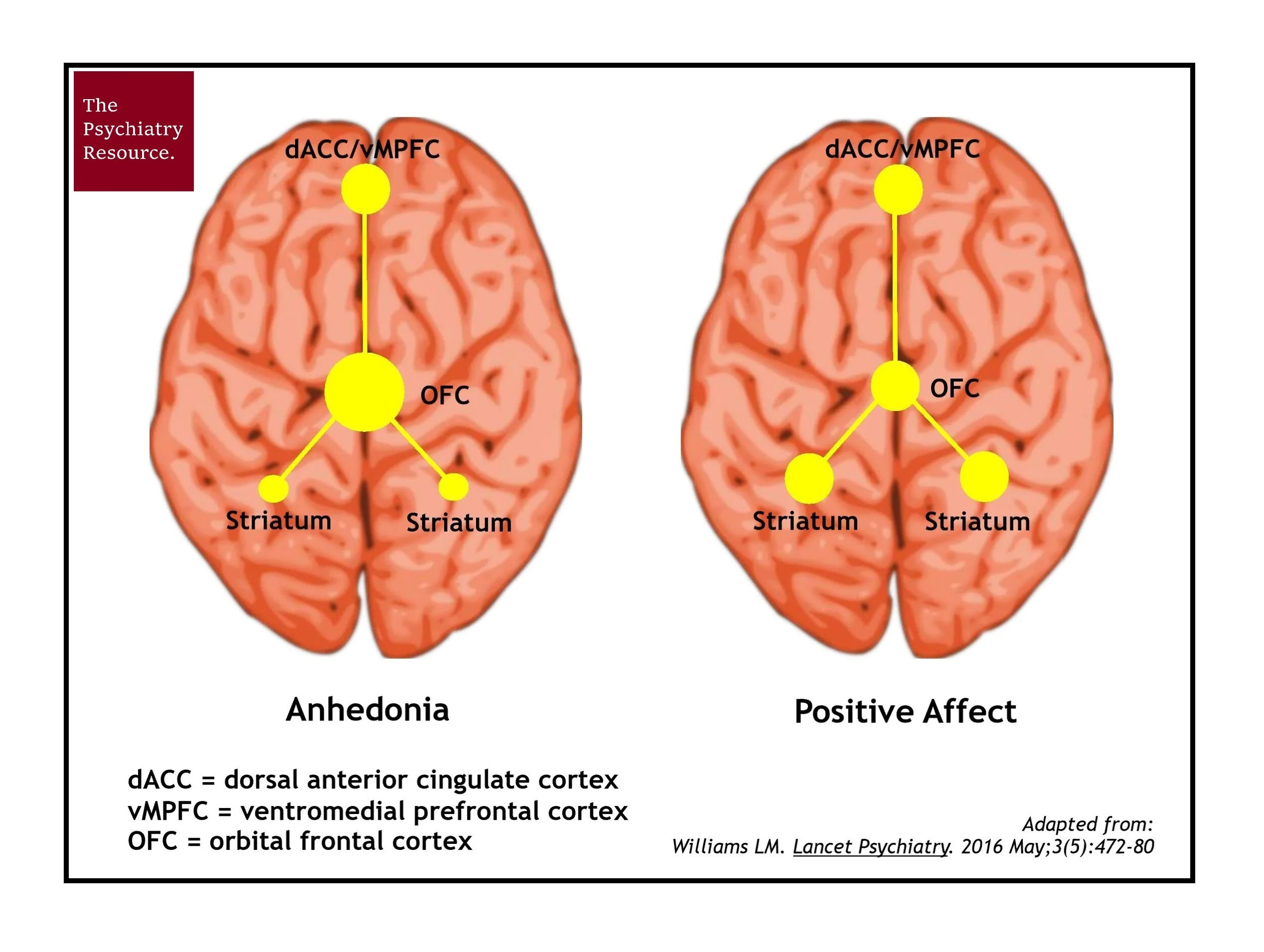 Image: Brain Activity in Depression by Len Lantz (CC BY-NC-ND)