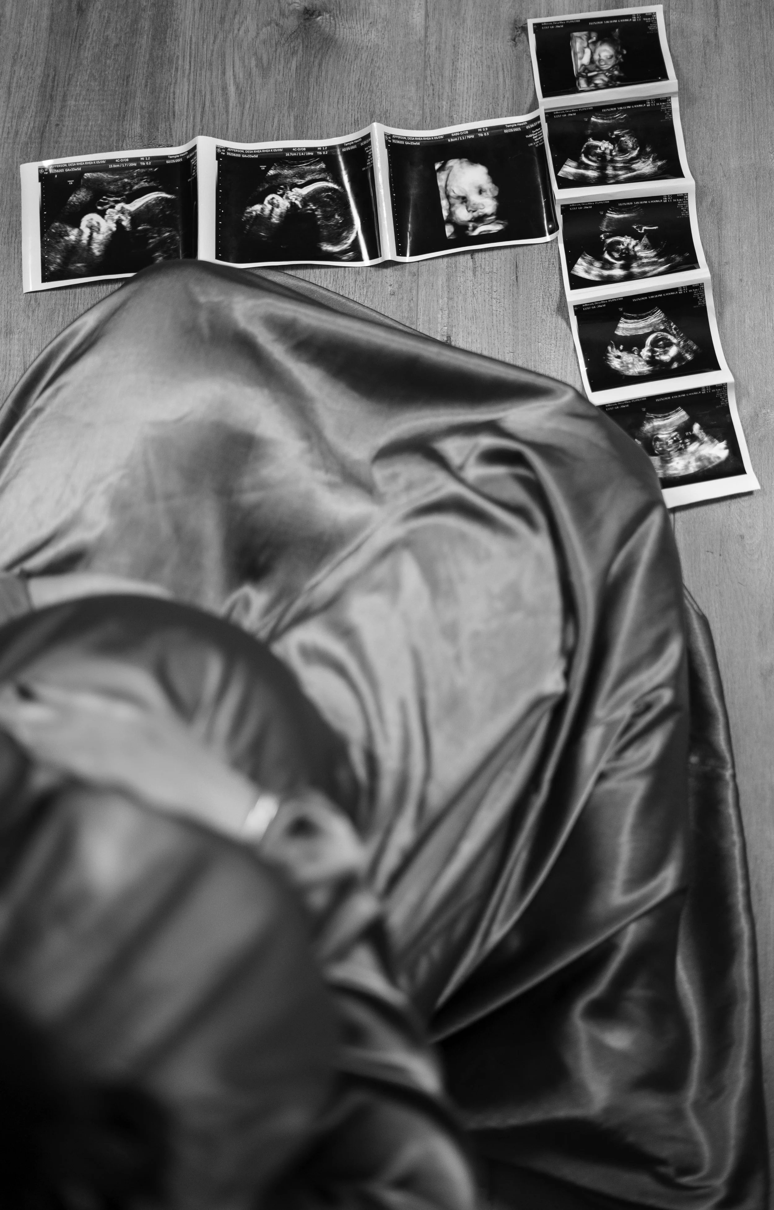 A person sitting on the floor with a foldable ultrasound photo album open displaying multiple ultrasound images of a baby and specialized ultrasound scans, taken during pregnancy.
