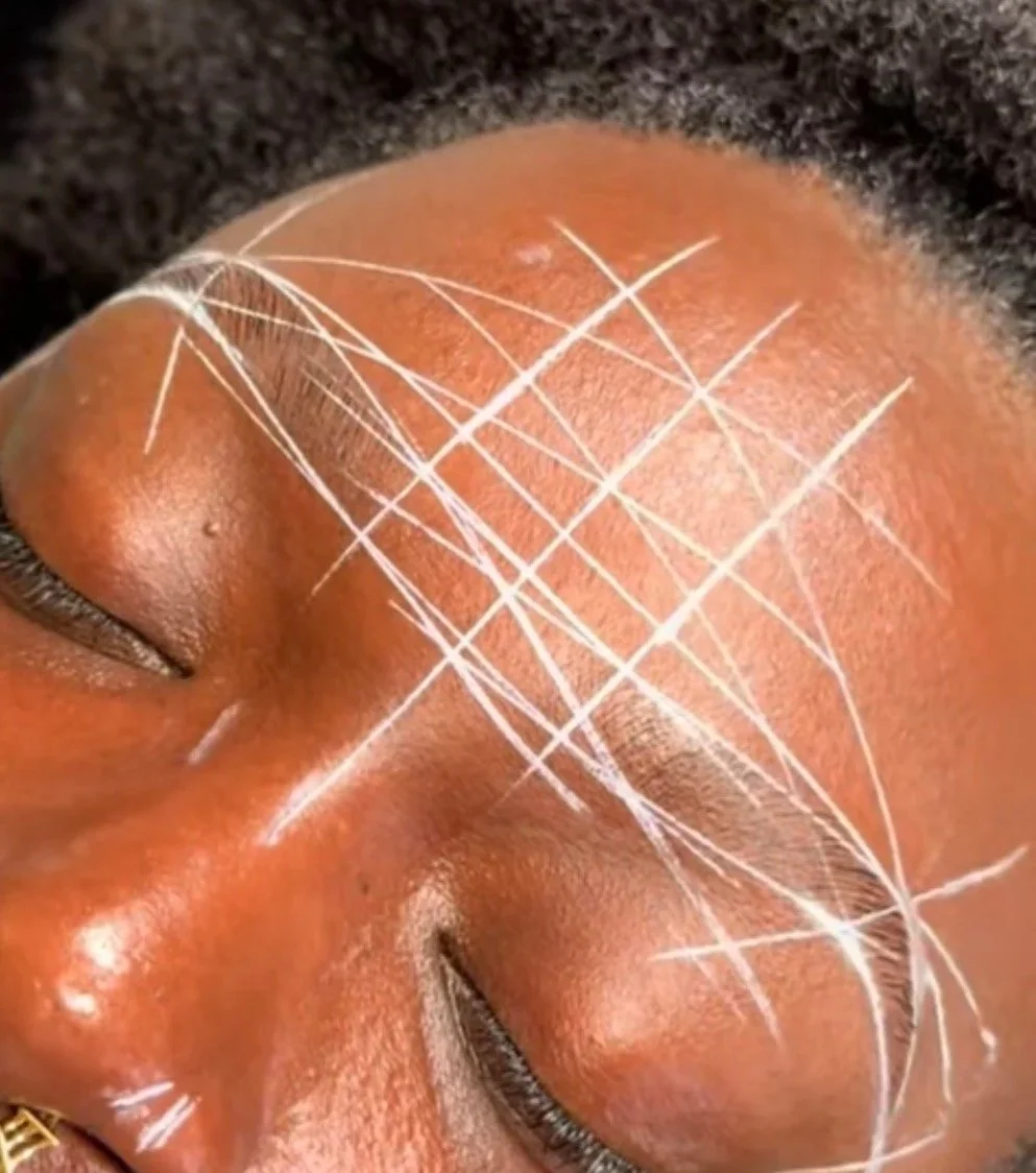 Close-up of a person's face with multiple white scratches on their forehead.
