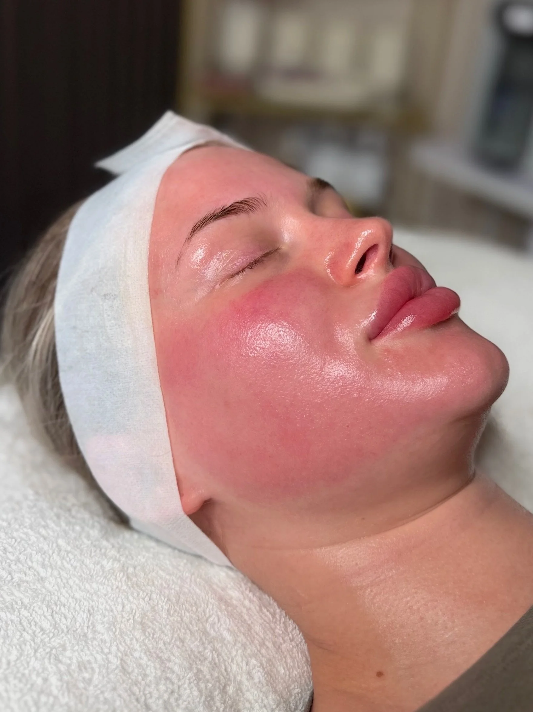 Have you seen such dreamiest skin&hellip;✨☁️🫶🏼🧸💭