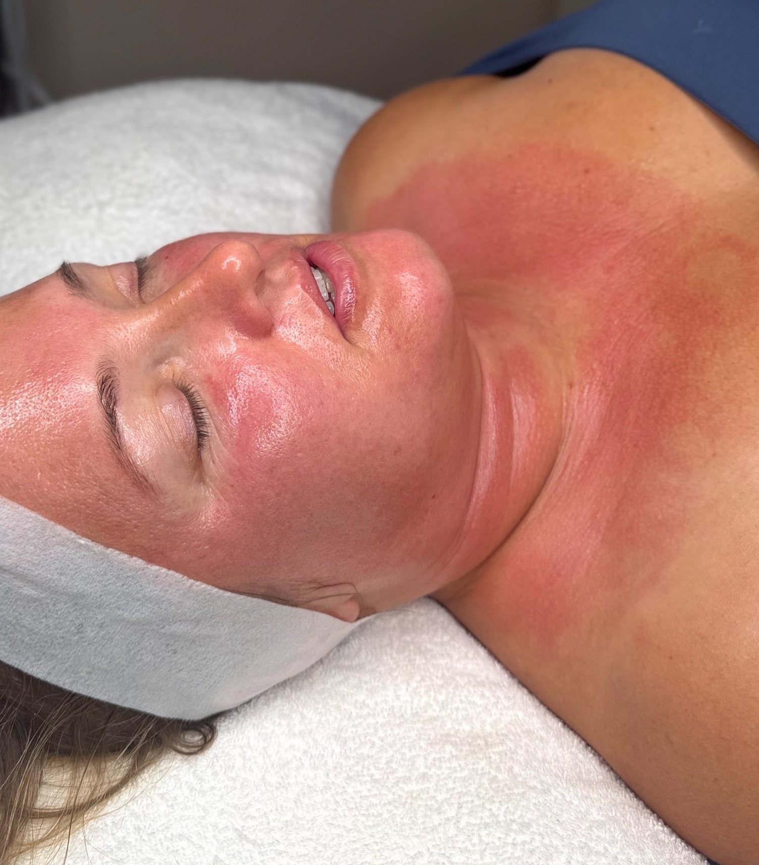 🚨 YOUR NECK CAN SHOW AGE BEFORE YOUR FACE DOES&hellip;

And yet, it&rsquo;s one of the areas we forget about the most! 👀

This is your reminder that your skincare routine shouldn&rsquo;t stop at your jawline 🤍

✨ Microneedling the neck can help im