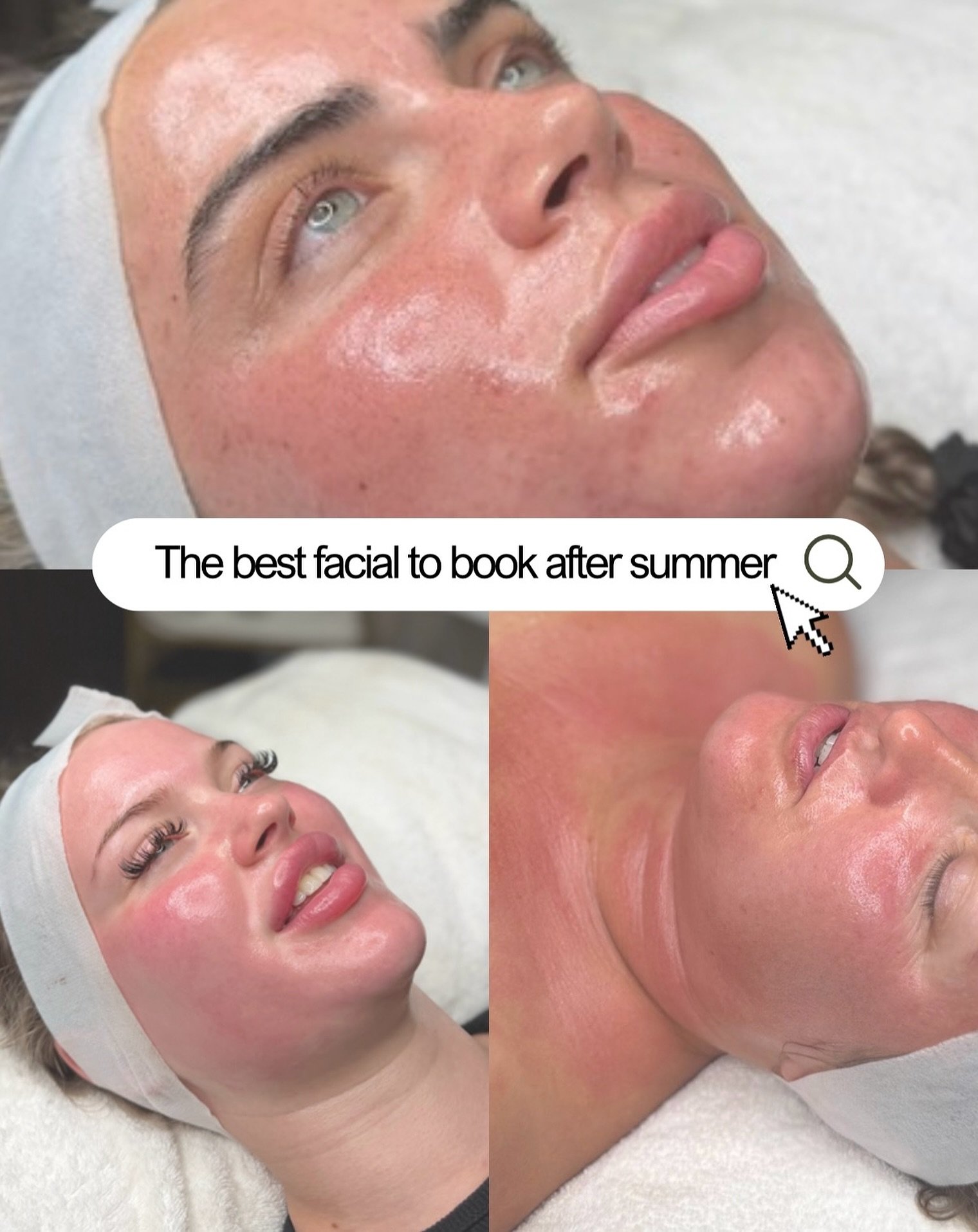 ☀️ SUMMER&rsquo;S OVER&hellip; TIME FOR A SKIN RESET 🪄🌨️

After the last few months of sunshine, holidays, SPF, sweat, heat, makeup and late nights&hellip; your skin deserves a little TLC🪄

Now is the perfect time to give your skin a proper post-s