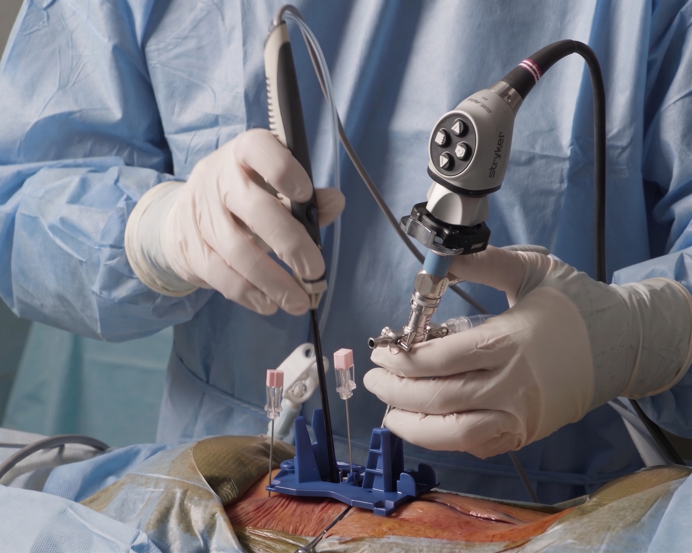 A surgeon in a blue gown and white gloves is performing a medical procedure with a specialized endoscope or surgical instrument over an operating table covered with sterile drapes.