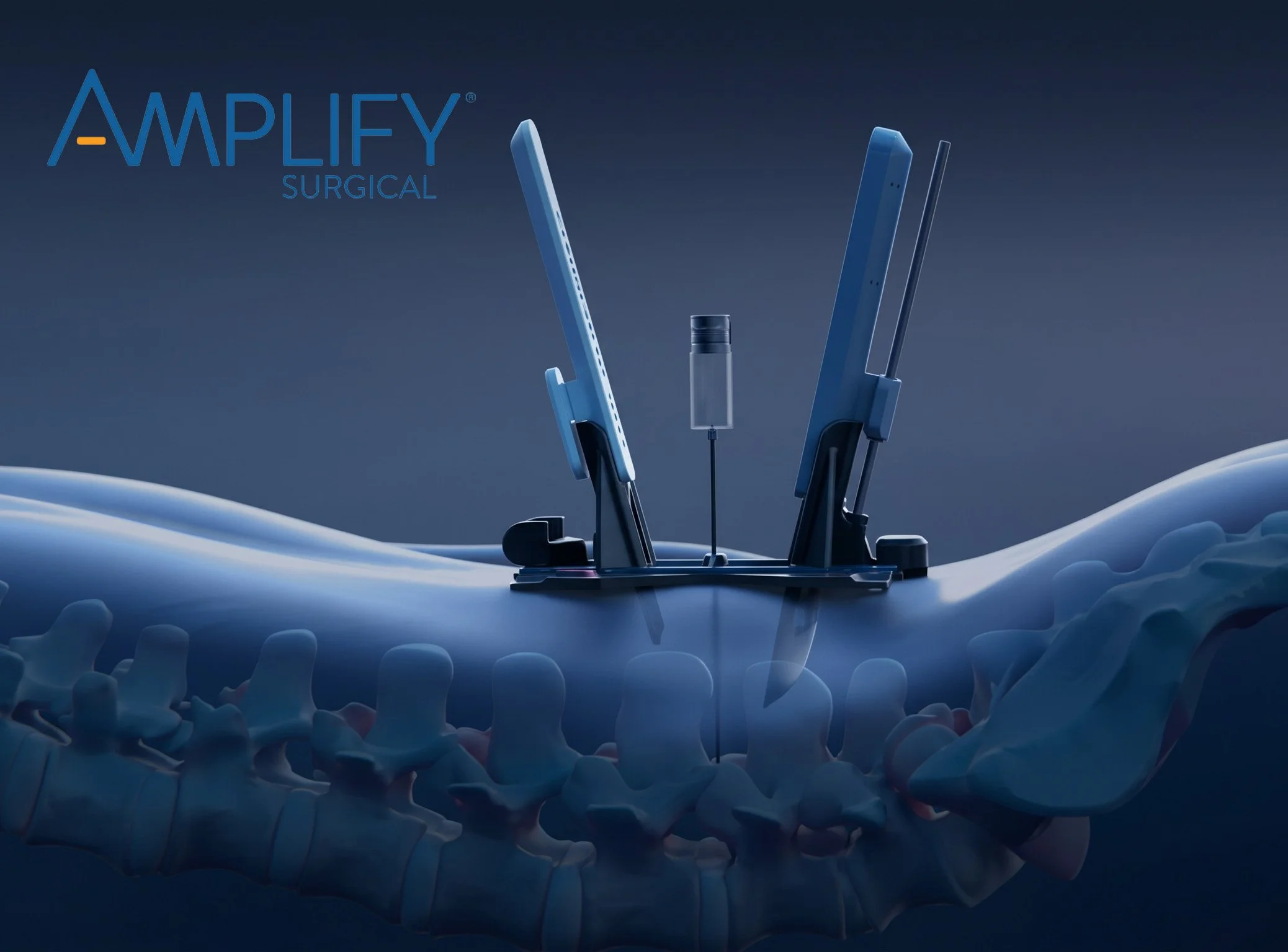A surgical setup with medical instruments and implants on a reflective surface, with a blue background and the text 'Amplify Surgical' in the upper left corner.