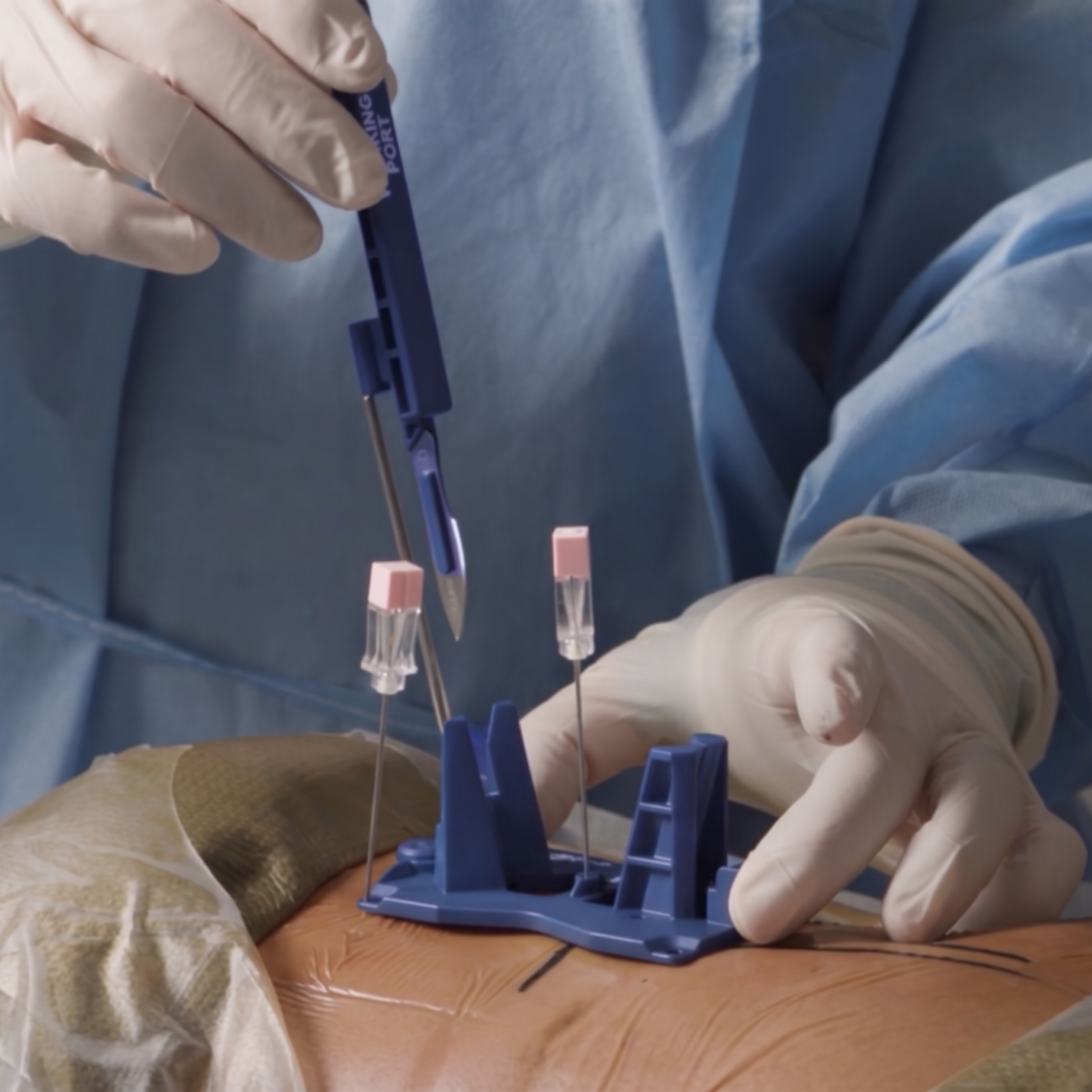 Medical professional wearing gloves drawing blood from a patient's arm using a needle and collection tubes.