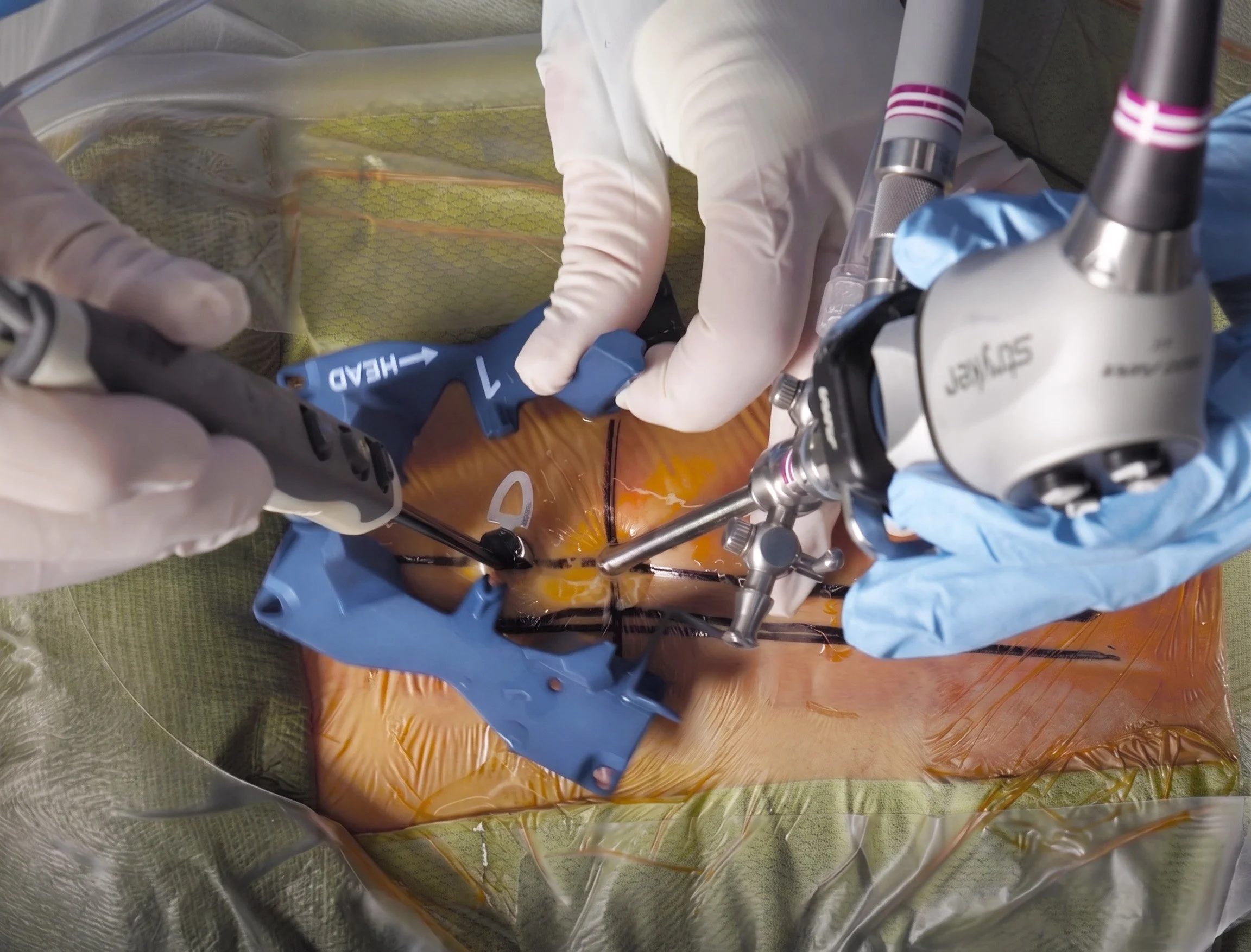 Surgeons performing a surgery with sterile tools and gloves, viewed from above.
