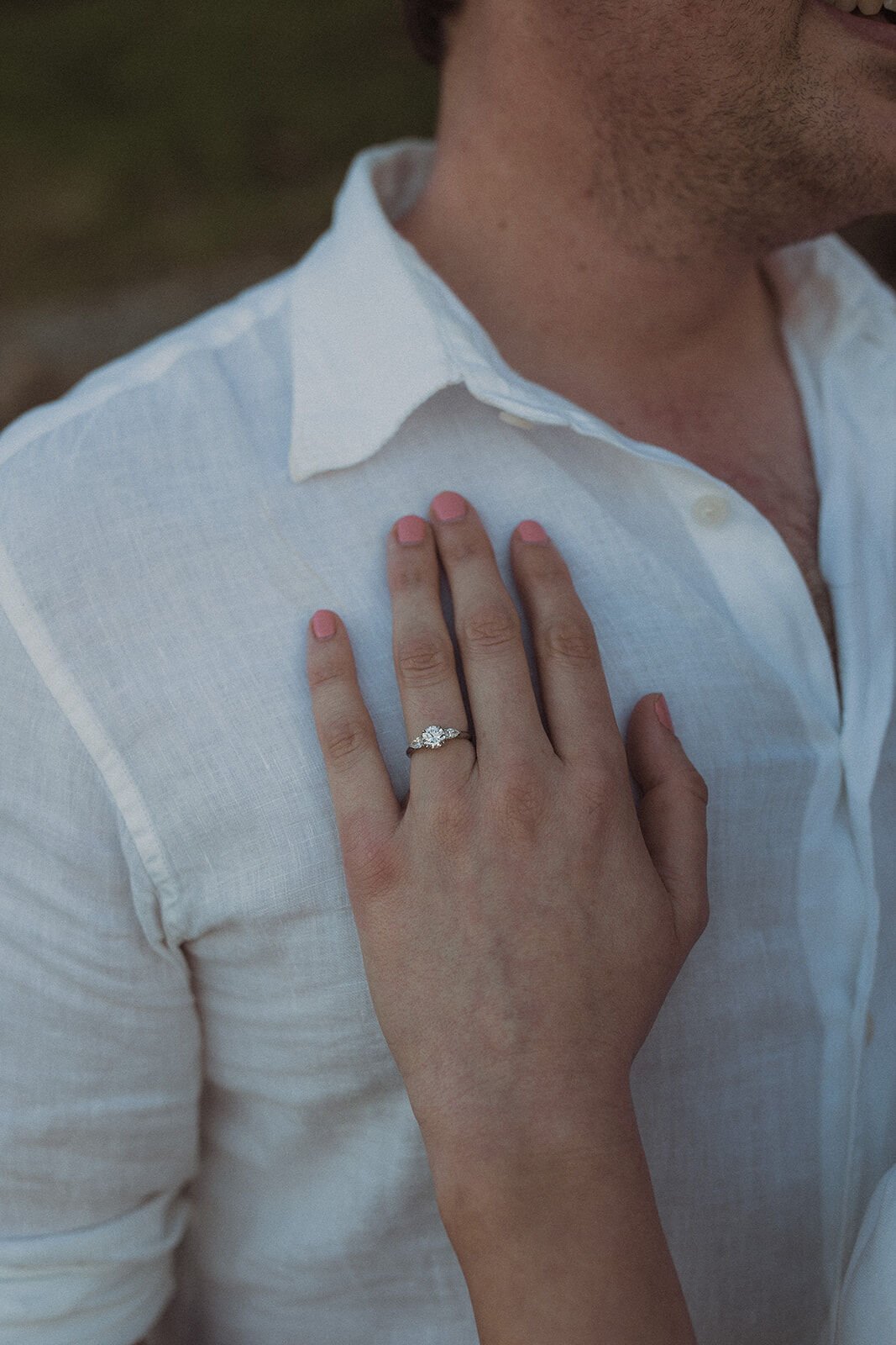 Close up of the engagement ring on her hand against his white shirt, John and Emma's sunset marriage proposal at Wategos Beach, Byron Bay