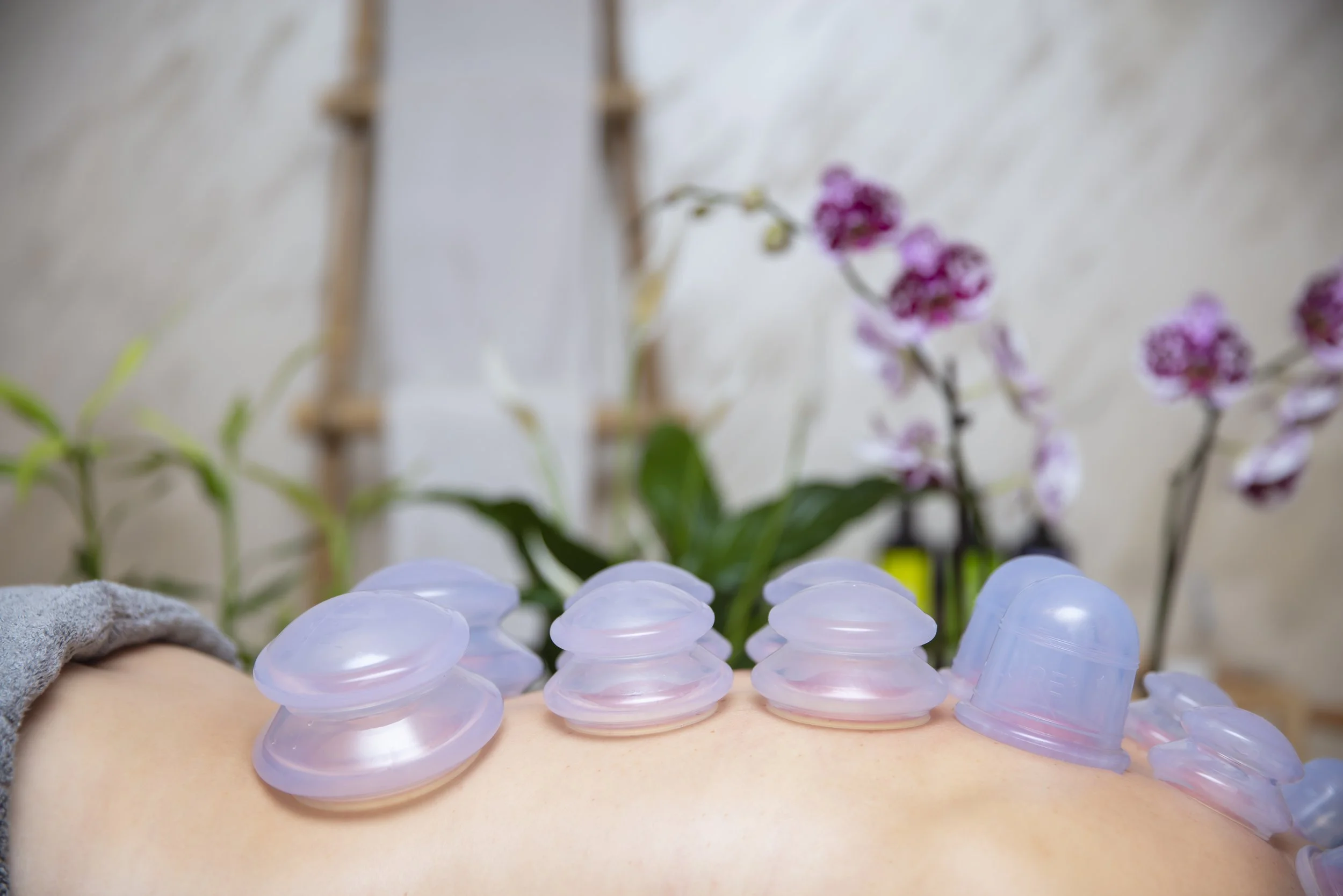 Close-up of a person's back receiving a cupping therapy session with multiple glass cups placed on their skin, with purple orchids and a blurred indoor setting in the background.