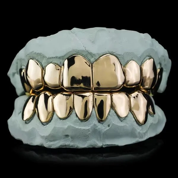 A dental mold with gold dental caps or crowns on teeth