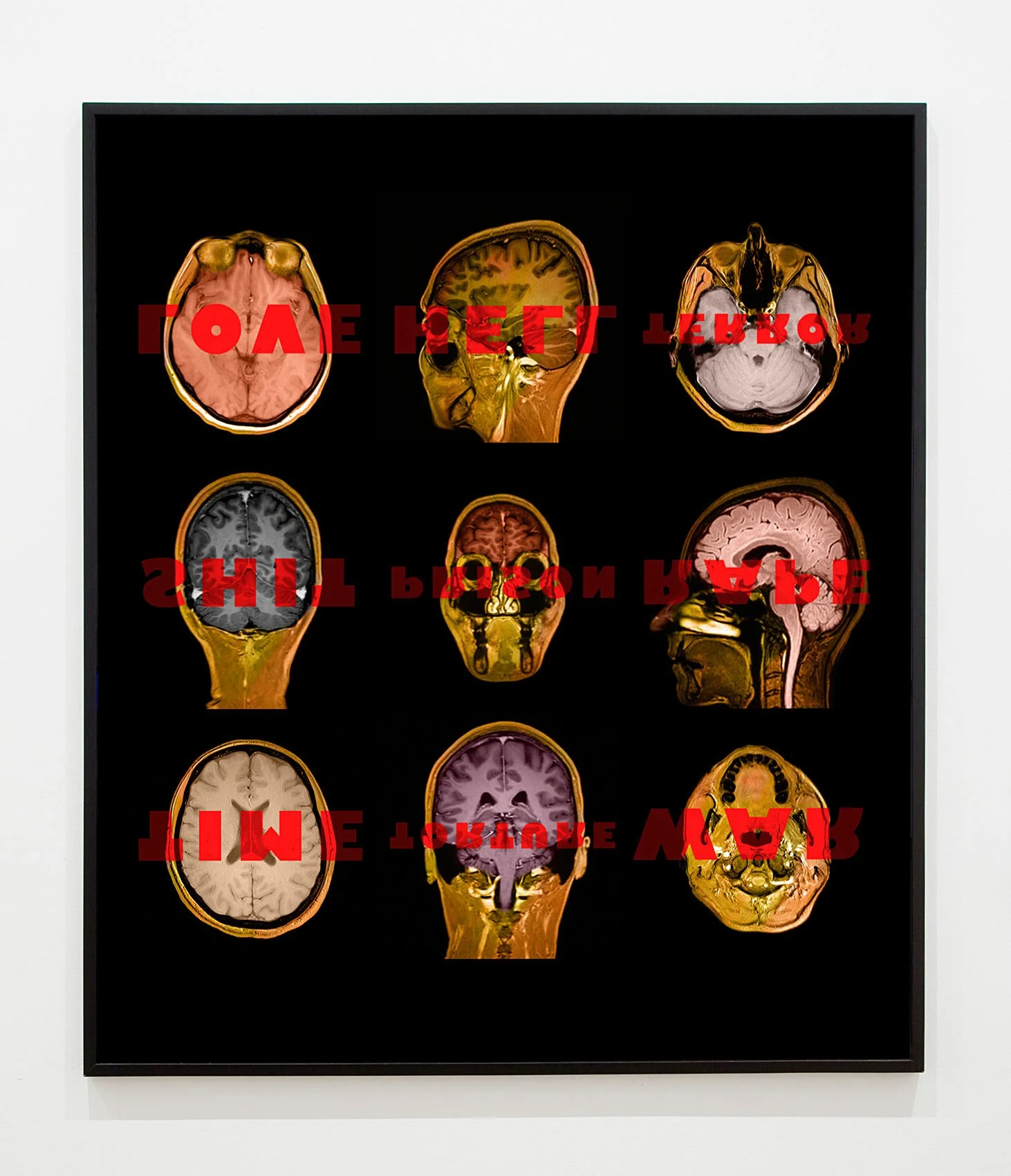 MRI. C-Print. 150 × 130 cm. 2023
