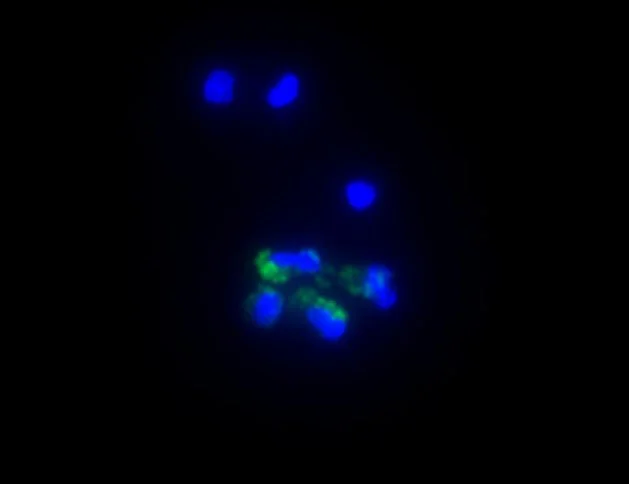 Hofbauer Cells