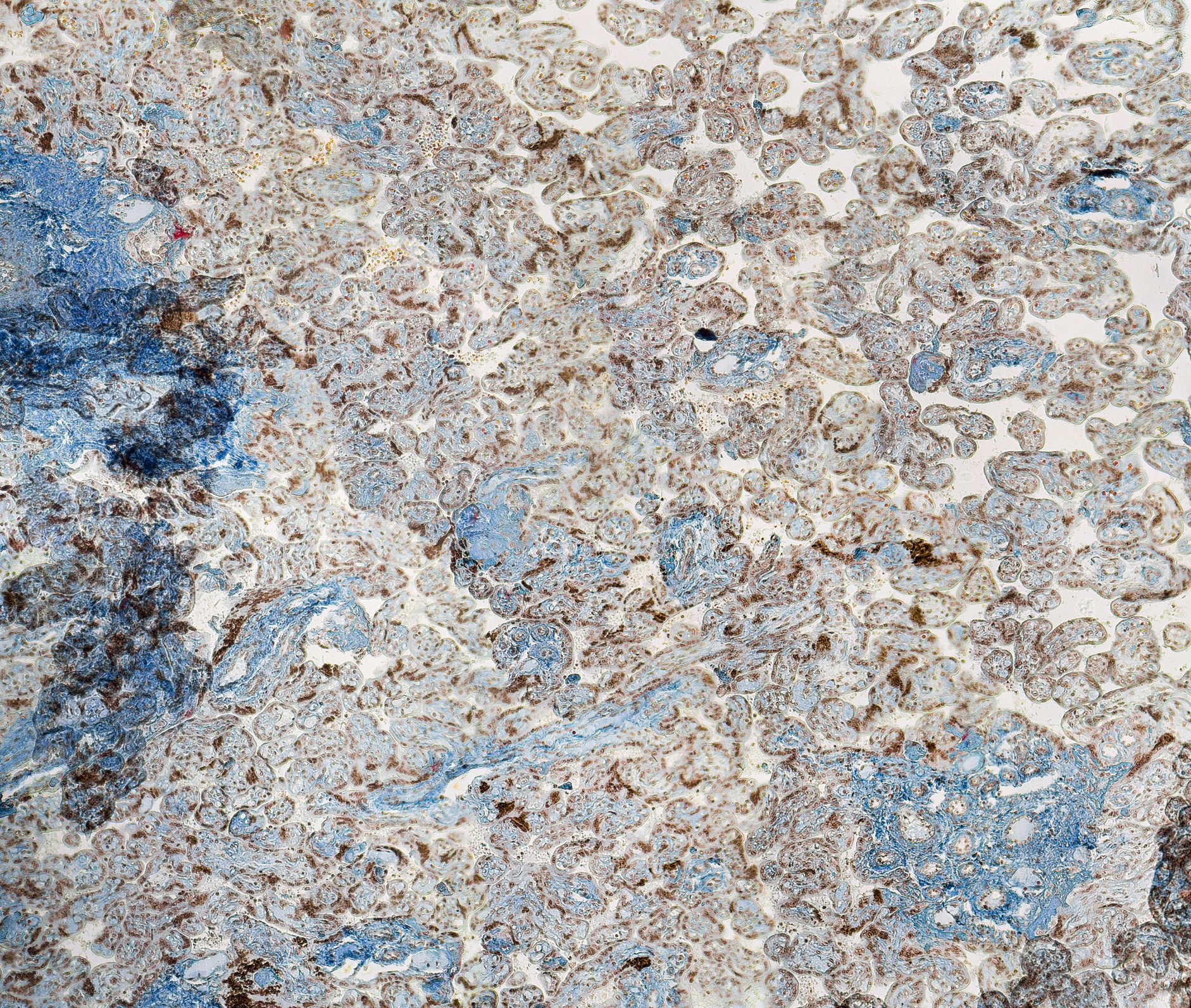 Placenta Histology Staining