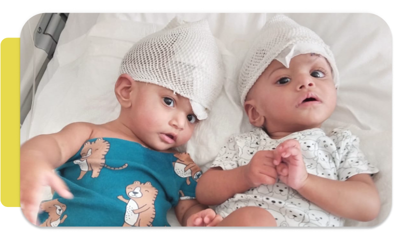 Two young children lying in a hospital bed wearing white mesh caps, with one child wearing a blue shirt with lion prints and the other wearing a light-colored shirt with a bear pattern.
