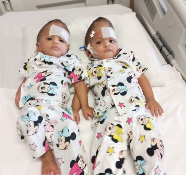 Two young children lying in hospital beds, wearing matching Minnie Mouse pajamas, with bandages on their heads.