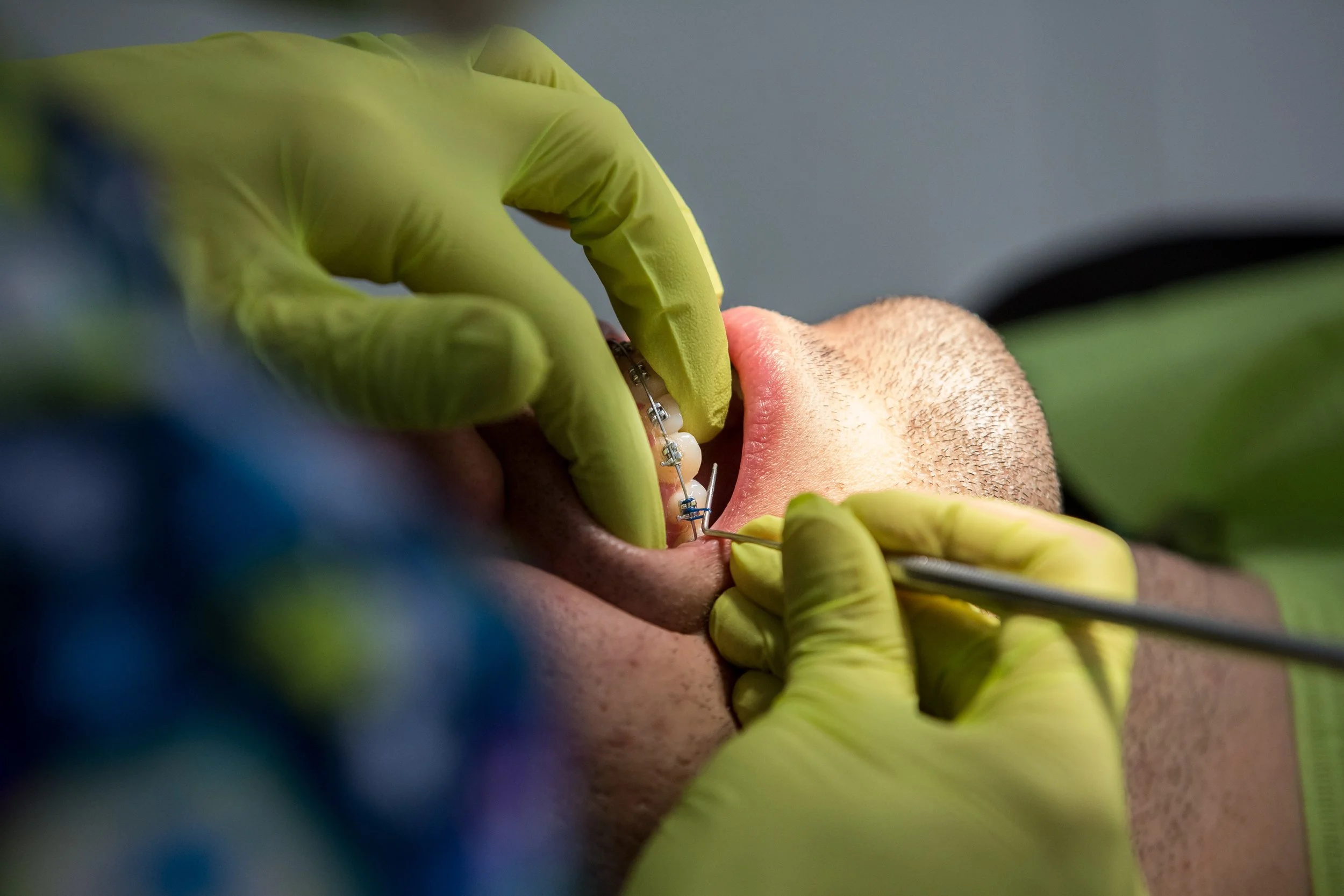 A dentist wearing green gloves performing a dental procedure on a patient with braces.
