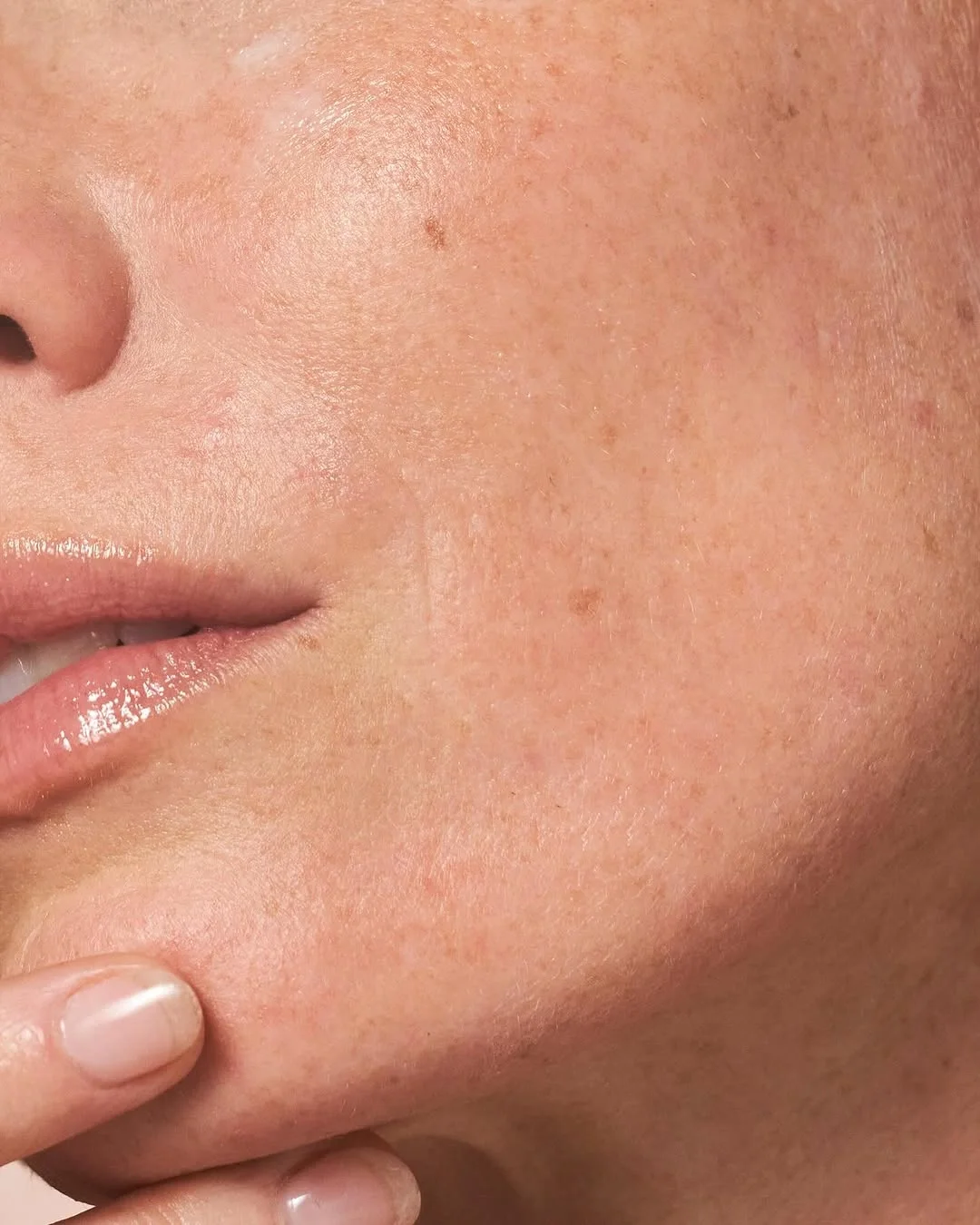 Close-up of a person's cheek, showing natural skin texture with freckles and a finger gently touching the skin.