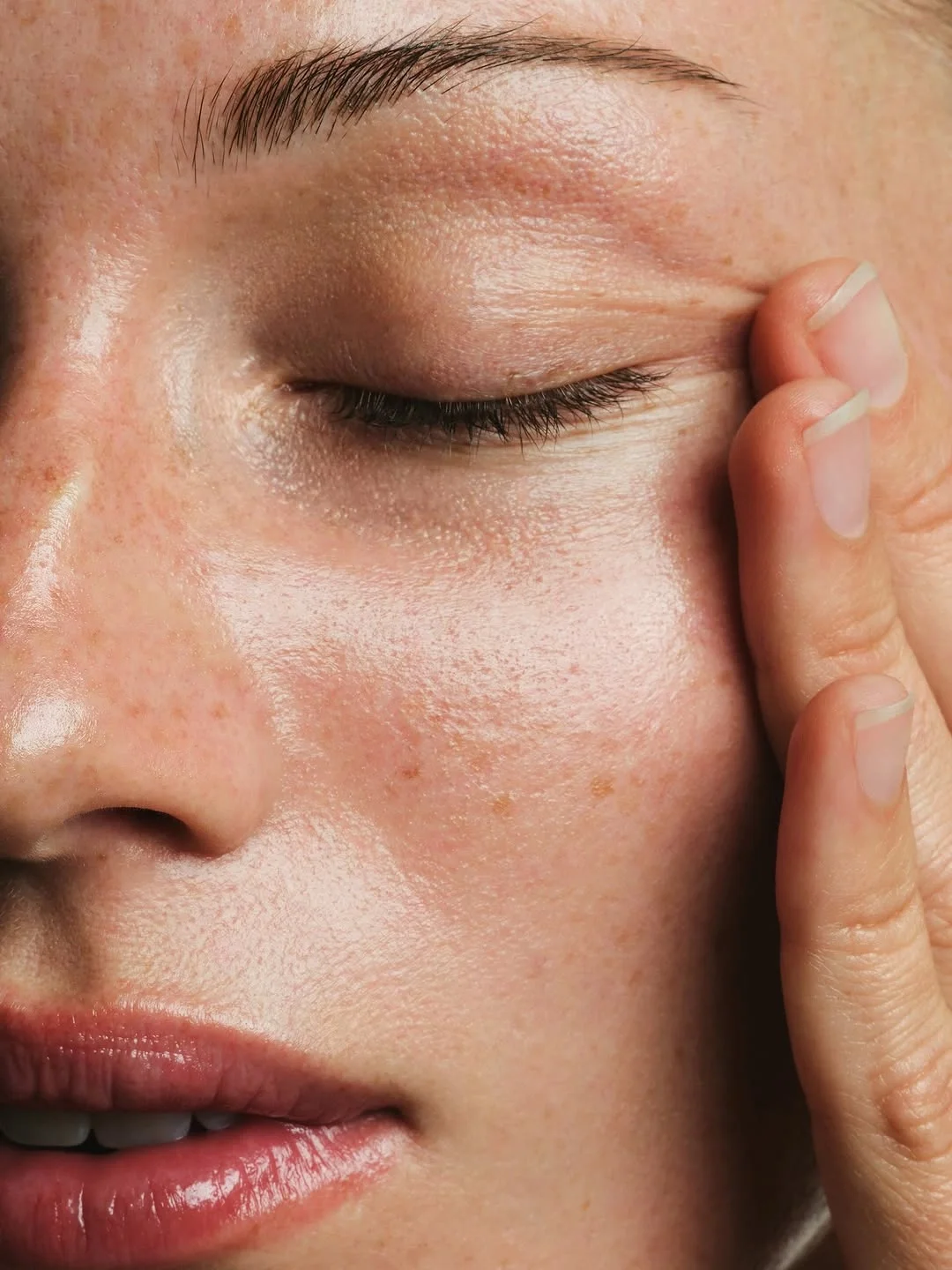 Close-up of a person's face with clear, glowy skin, after receiving a treatment from a med spa.