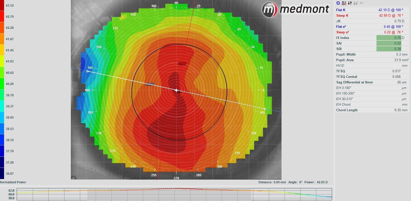 Corneal topography map showing detailed measurements of the cornea's shape and curvature. The map displays a color gradient from blue to red, indicating the cornea's elevation, with red areas representing higher elevation and blue areas indicating lower elevation. Numerical data and measurements are on the right side of the image.