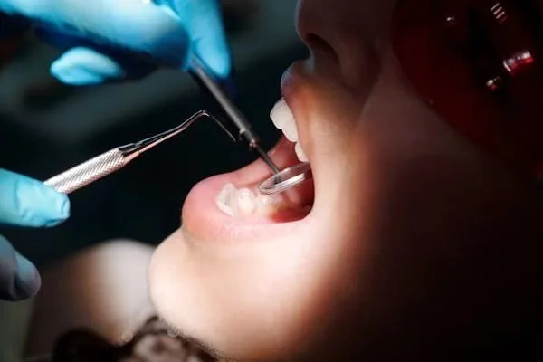 Dental procedure with a person undergoing treatment, dentist using dental tools.