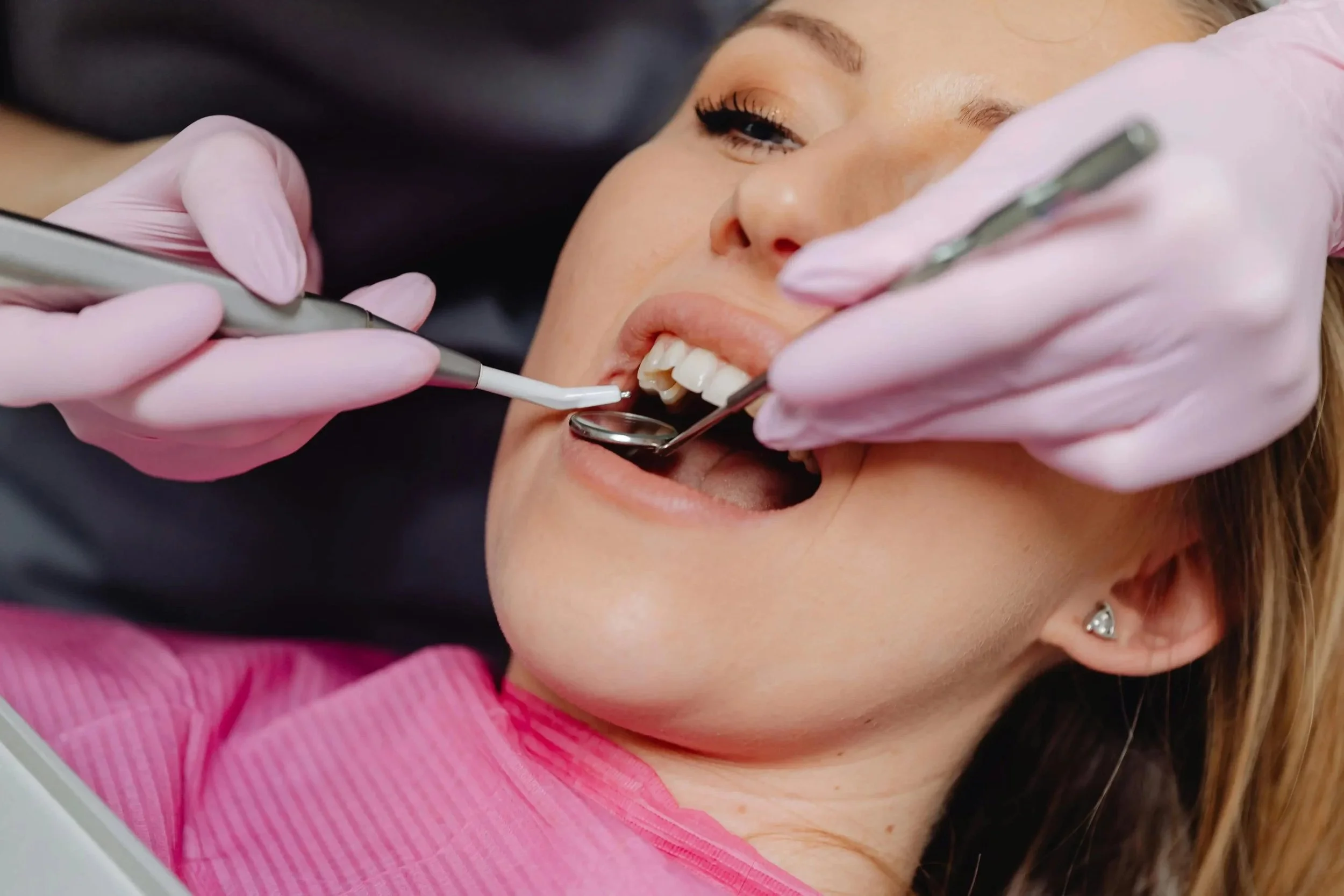 A woman lying back with her mouth open, receiving dental care from a dentist. The dentist's gloved hands hold dental tools near her teeth.