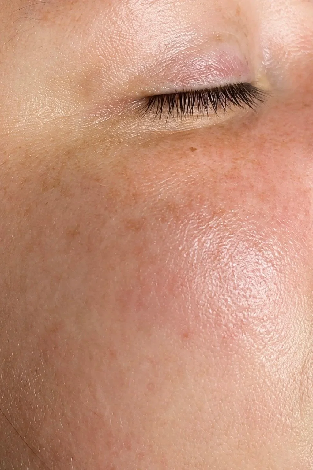 Can You Actually Shrink Your Pores?