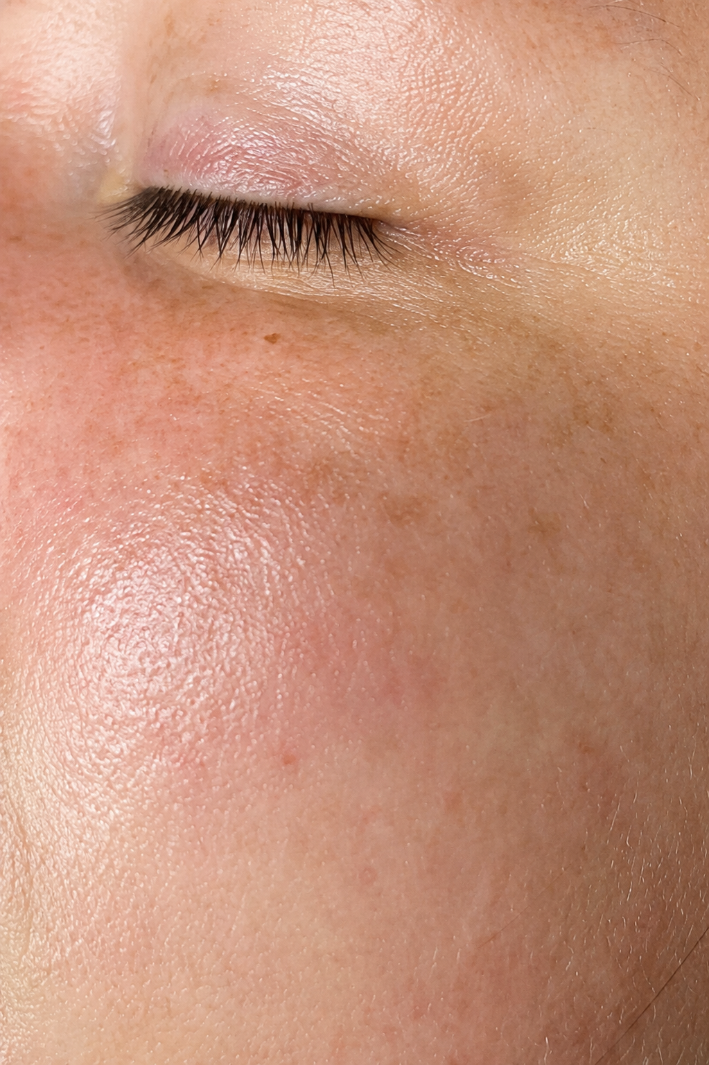 natural skin image after a facial