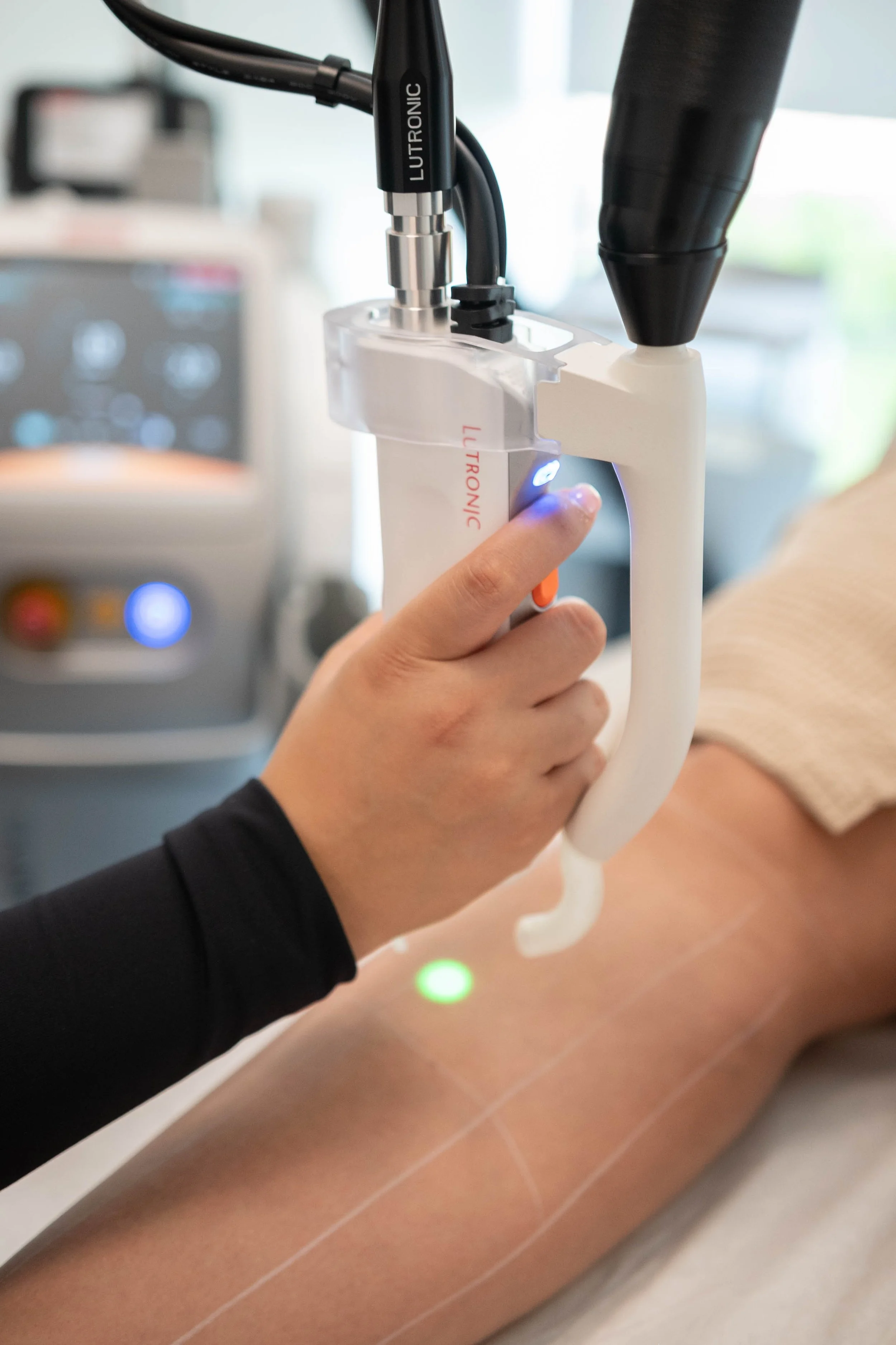 Une personne reçoit une injection intraveineuse dans le bras lors d'une procédure médicale, avec un dispositif médical en place.