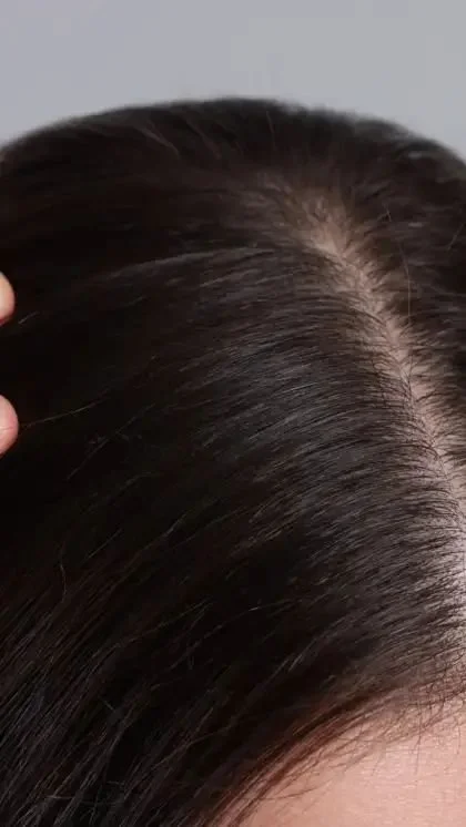 Cuir chevelu avec racines visibles dans des cheveux noirs brillants.