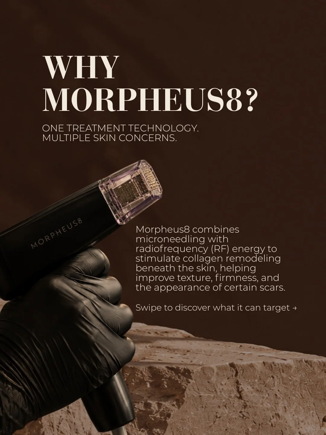 Acne scars, loose skin, or uneven texture? Edmonton, let&rsquo;s talk Morpheus8. 👀

One treatment technology. Multiple skin concerns.
✨ ACNE SCARRING: Helps improve the appearance of certain acne scars.
✨ LIFTING + TIGHTENING: Helps firm skin and im