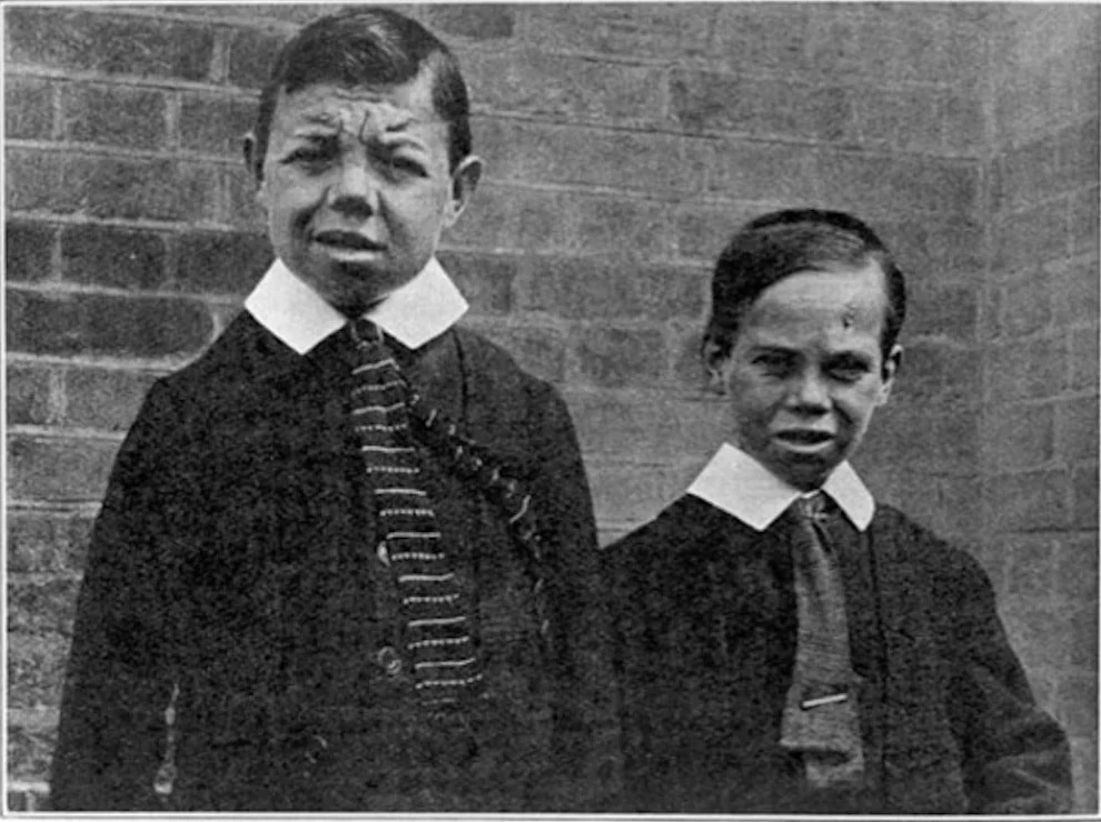 Two young mend wearing a suit and ties, captions Two 'feeble-minded cretins' aged twenty-two and twenty-one, Dartford. (Wellcome images)