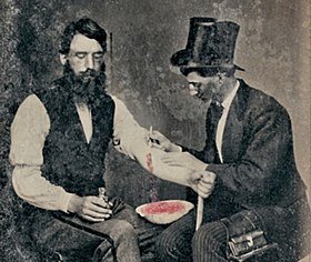 Two men sat in chairs, the one on the right is wearing a top hat and a suit is collecting blood from the man on the left.