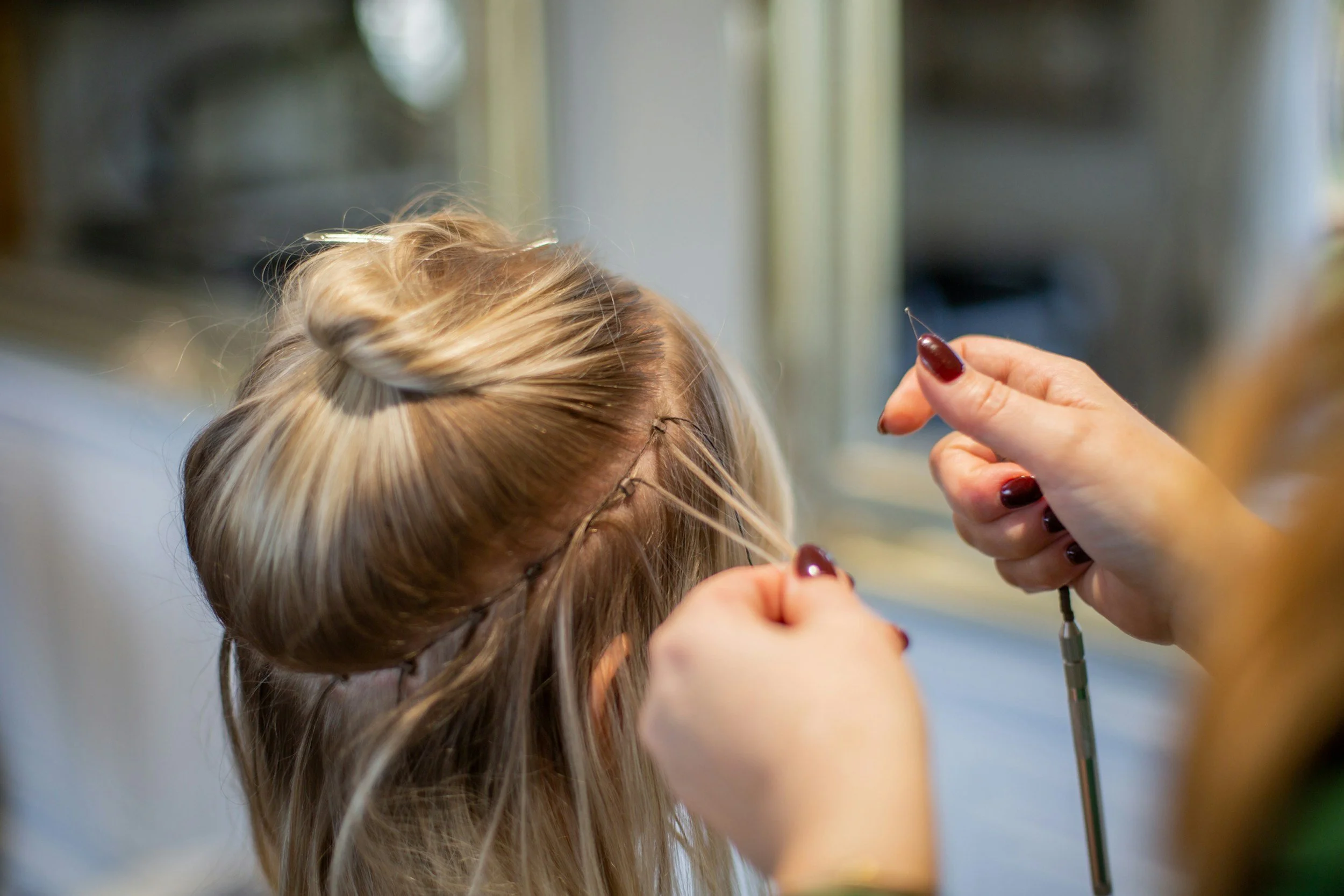 A person with painted nails is performing a cosmetic procedure on a patient's scalp, involving a thin needle or probe near the hairline.