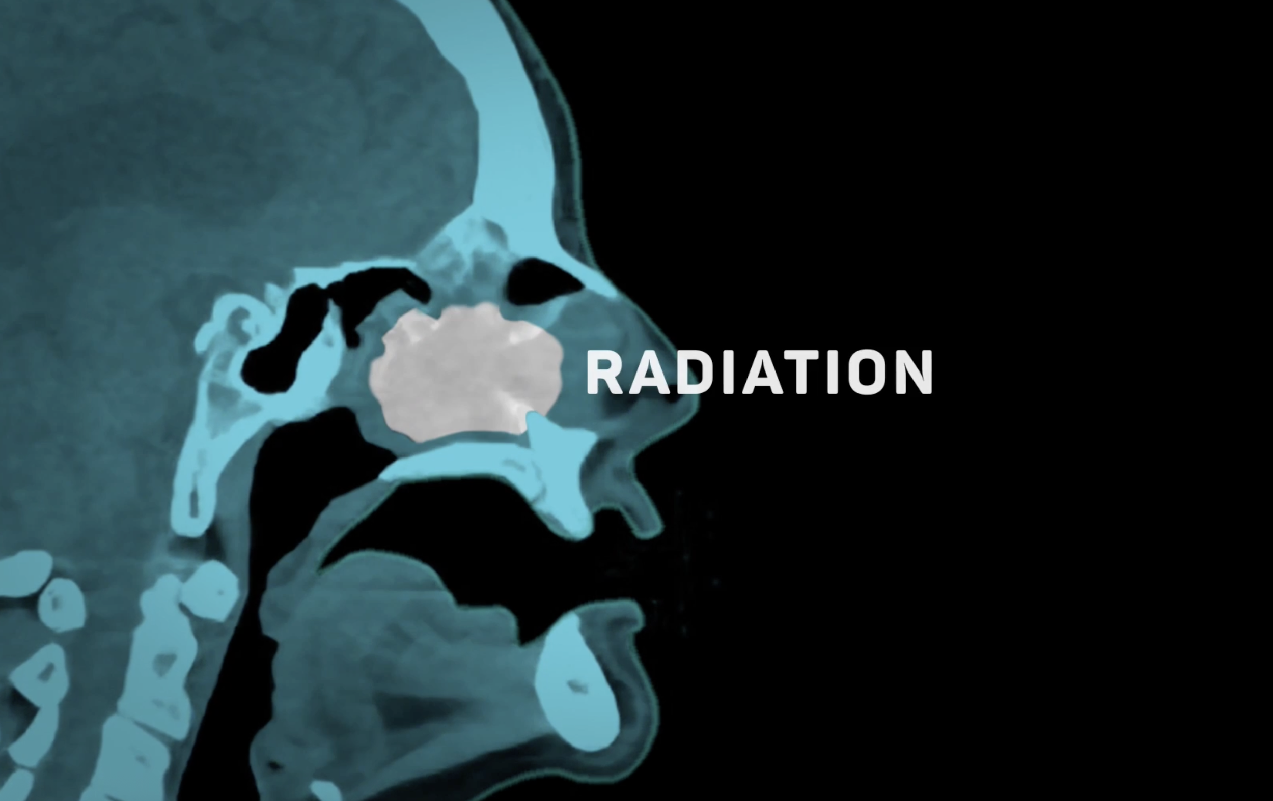 Seattle Proton Therapy