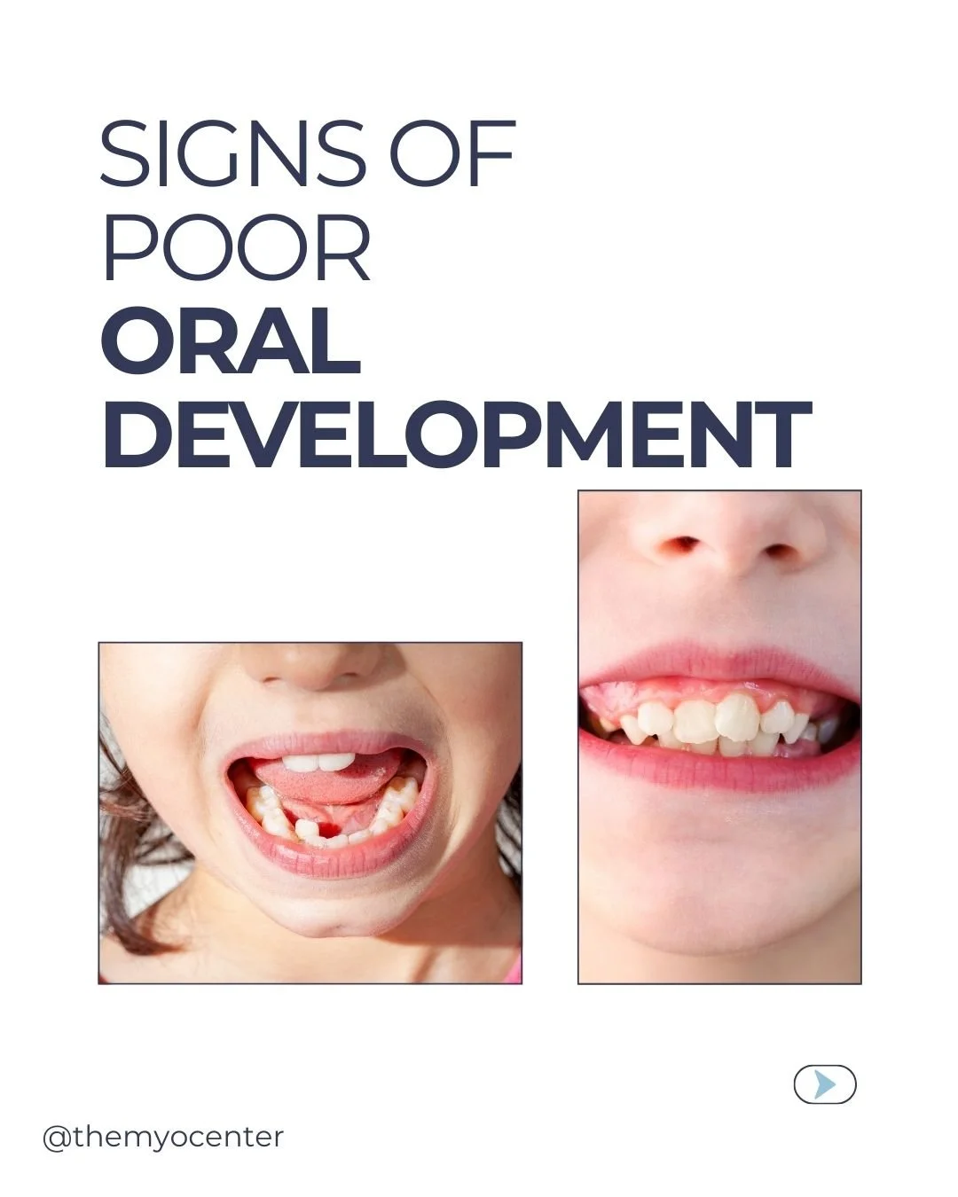 Why Teeth Move Back: Insights from an Orthodontic Relapse Specialist