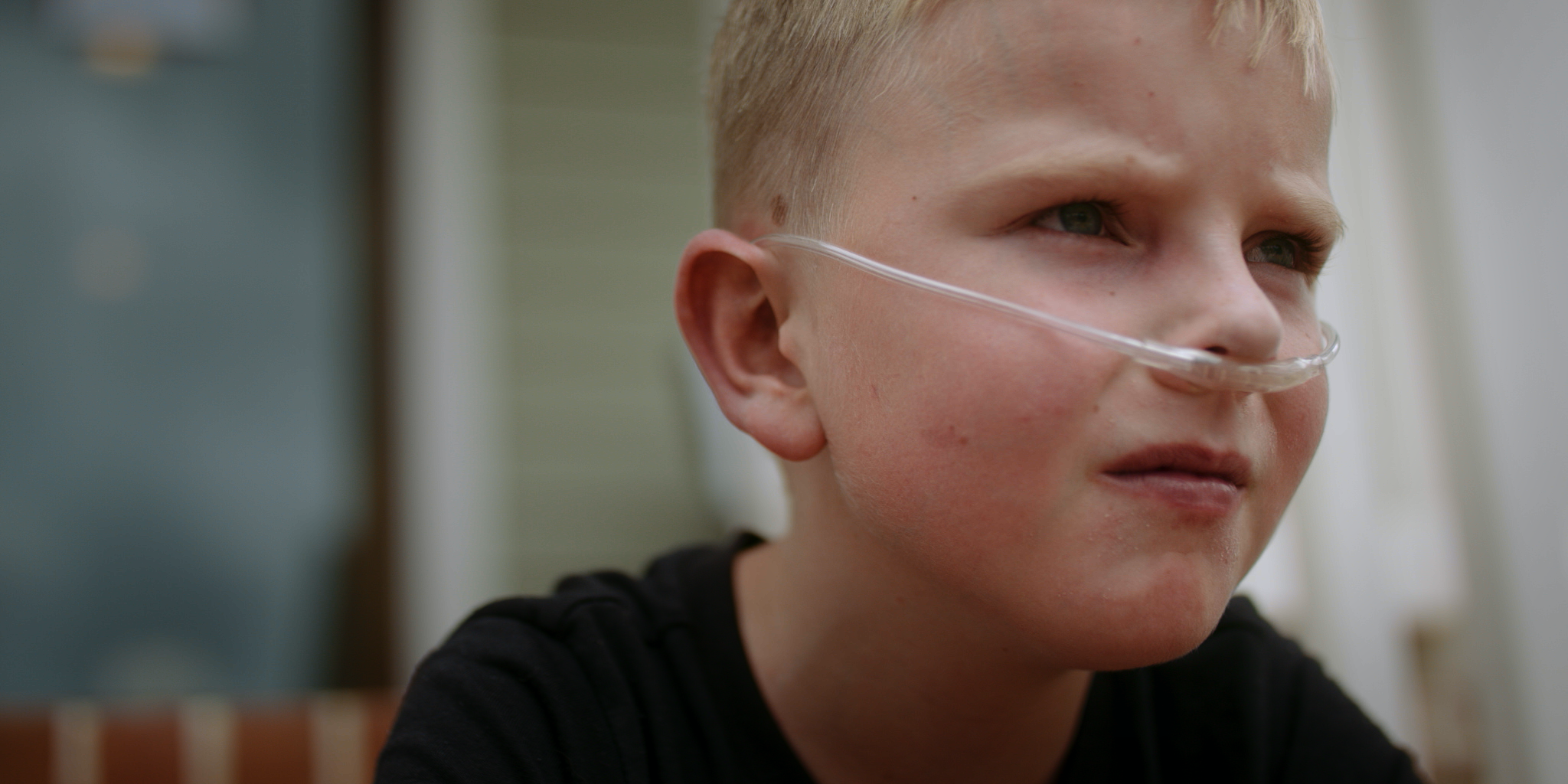 Close-up of a young boy with short blond hair, wearing a nasal cannula, looking to the side with a serious expression.
