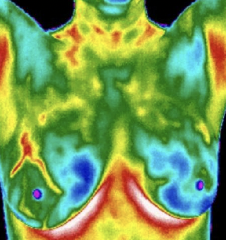 Thermal image of a person's upper body showing body heat distribution.