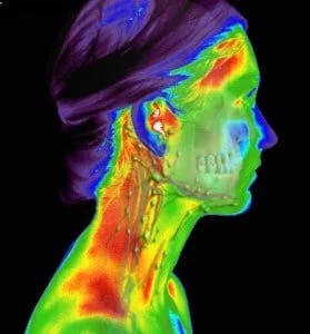 Colorized thermal imaging scan of a human head, neck, and shoulders in profile.