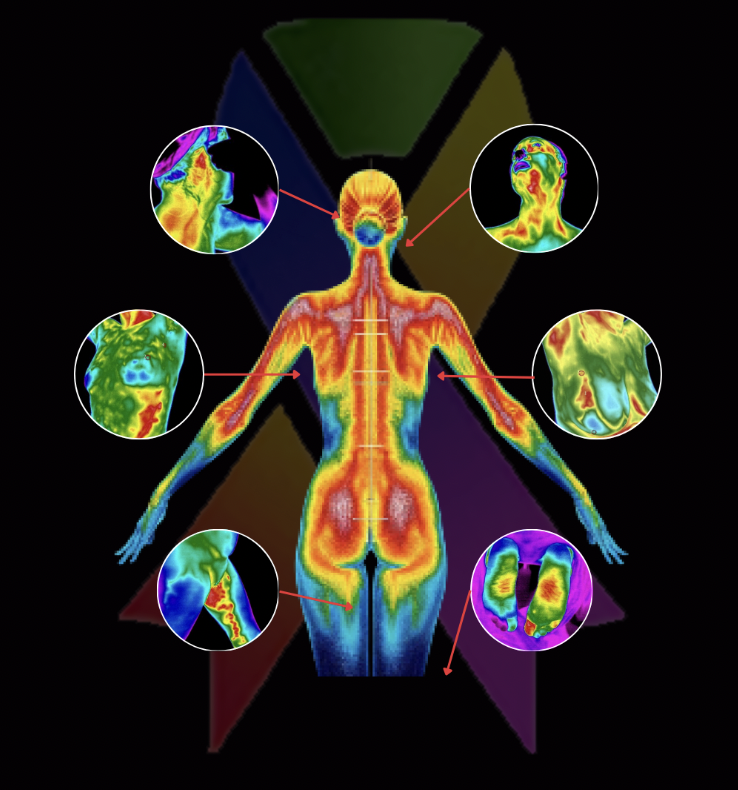 Infrared thermal image of a human figure showing heat distribution in different body parts, with detailed close-ups of the head, chest, elbows, knees, and feet.
