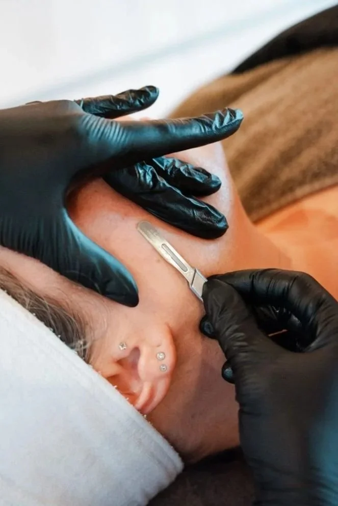 Dermaplaning+%40+Delphine+Debeuf+_+Beauty+%26+Skincare.jpg