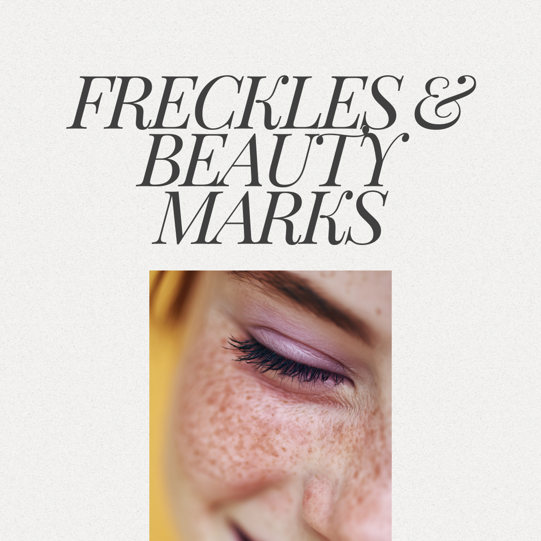 Freckles & Beauty Marks