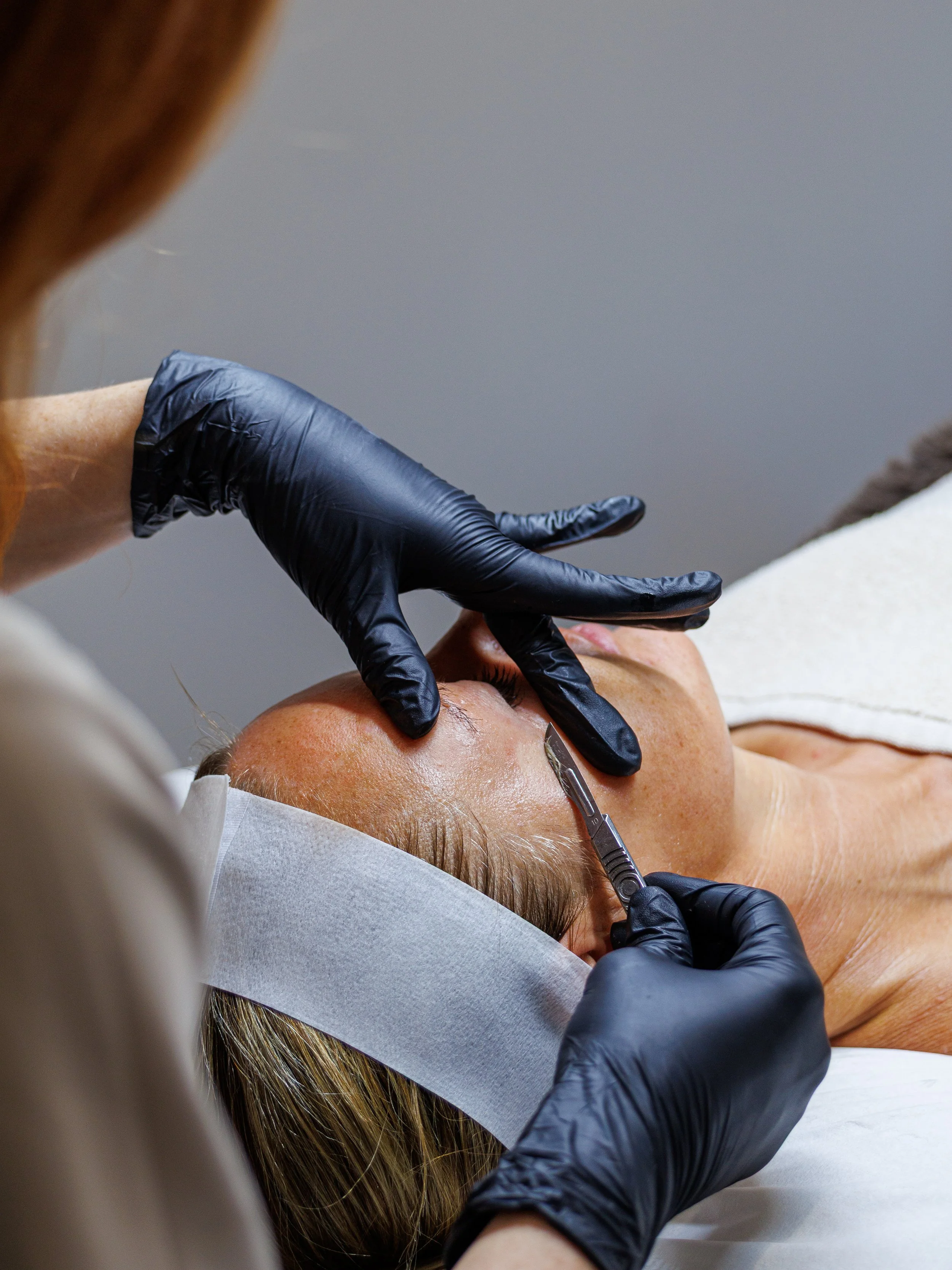 A person in black gloves is performing a cosmetic procedure on a woman's face, possibly injecting or administering treatment in an clinical setting.