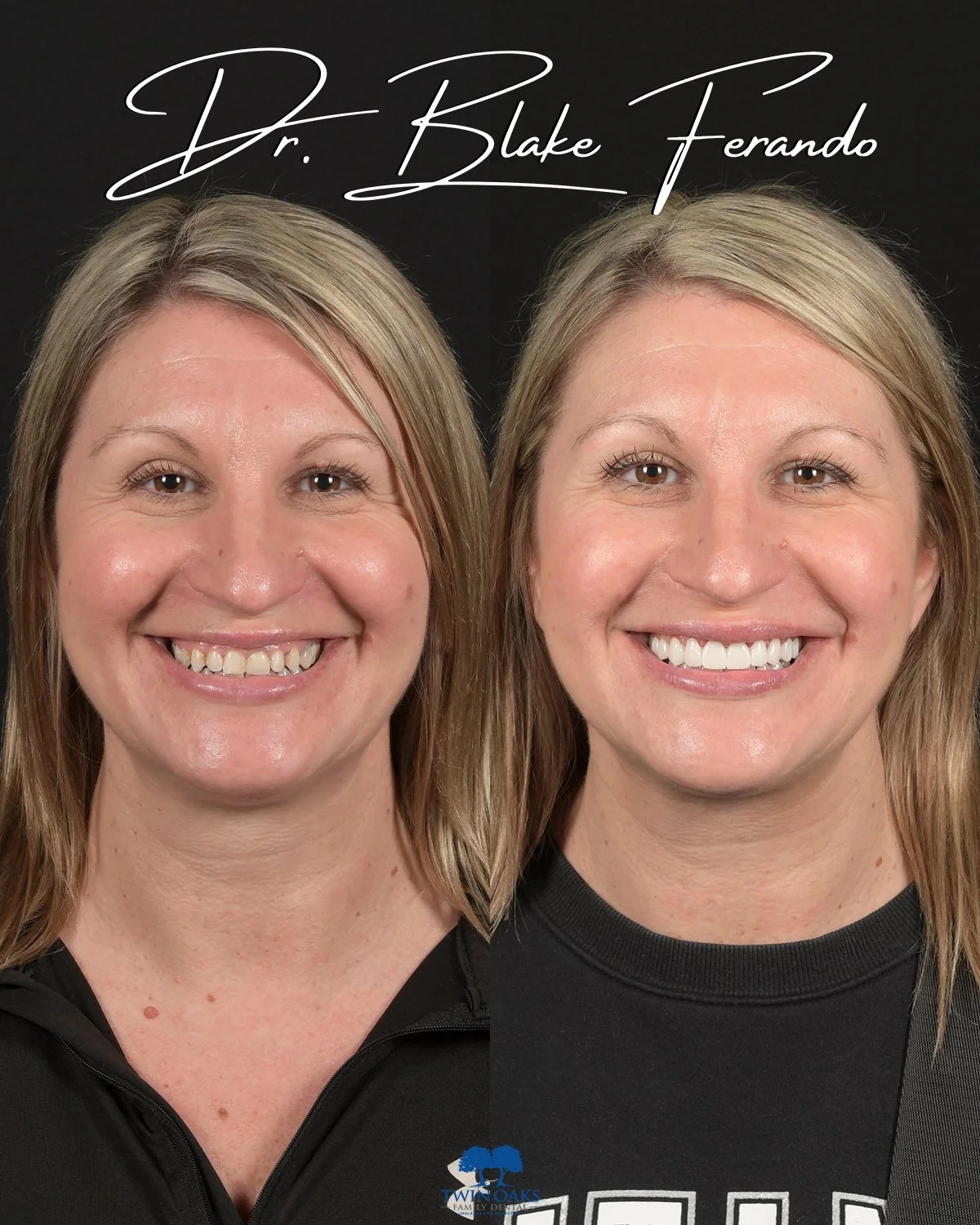 Before & After Photo 1