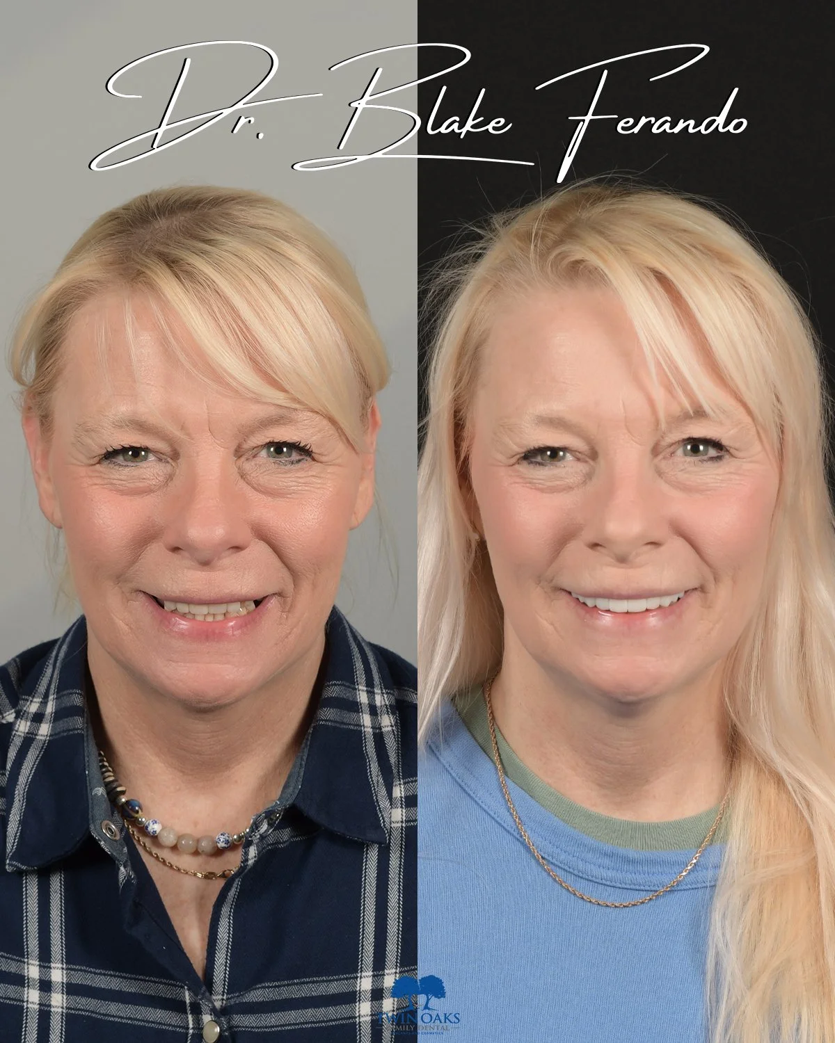 Before & After Photo 3