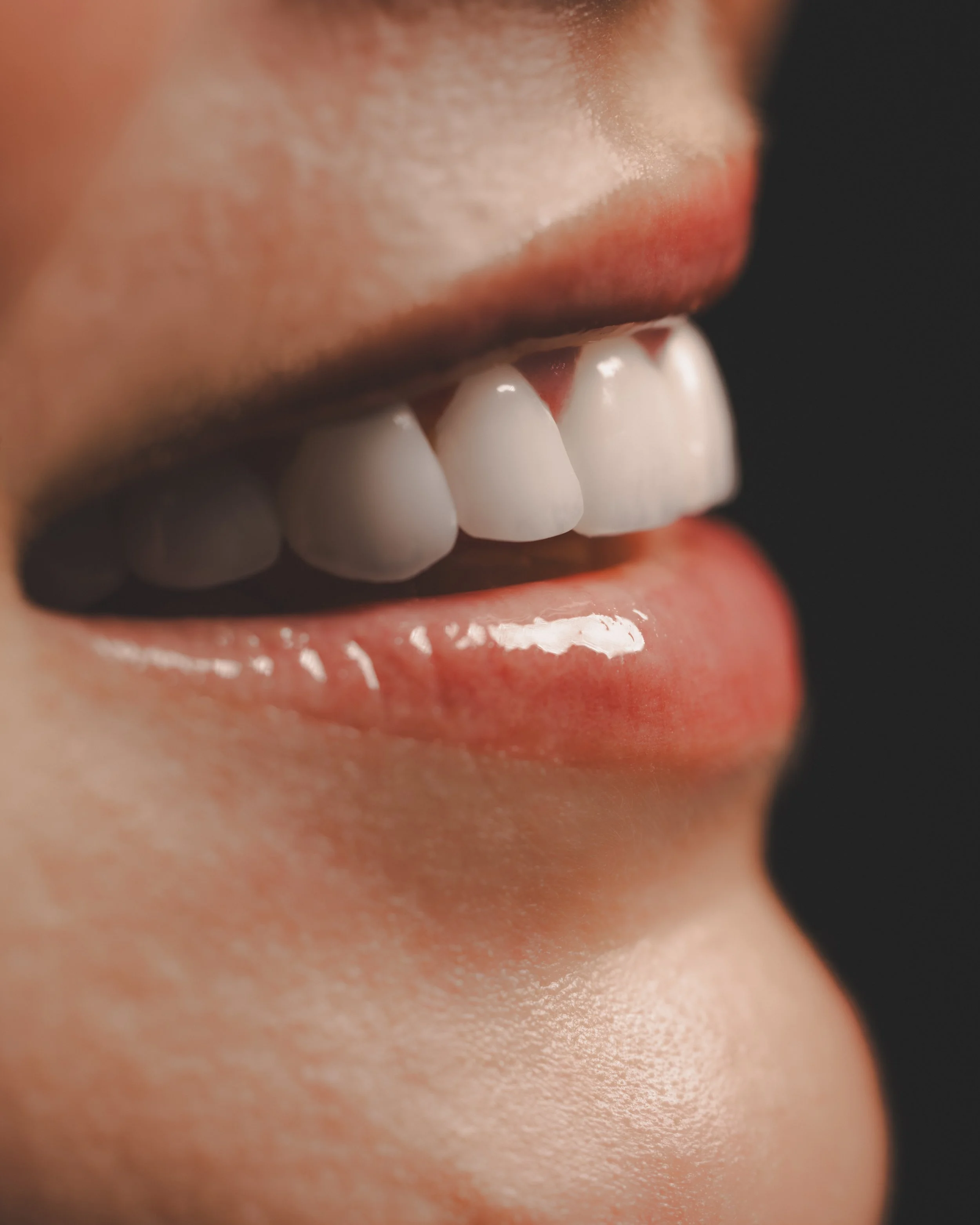 Patient Veneers Close Up