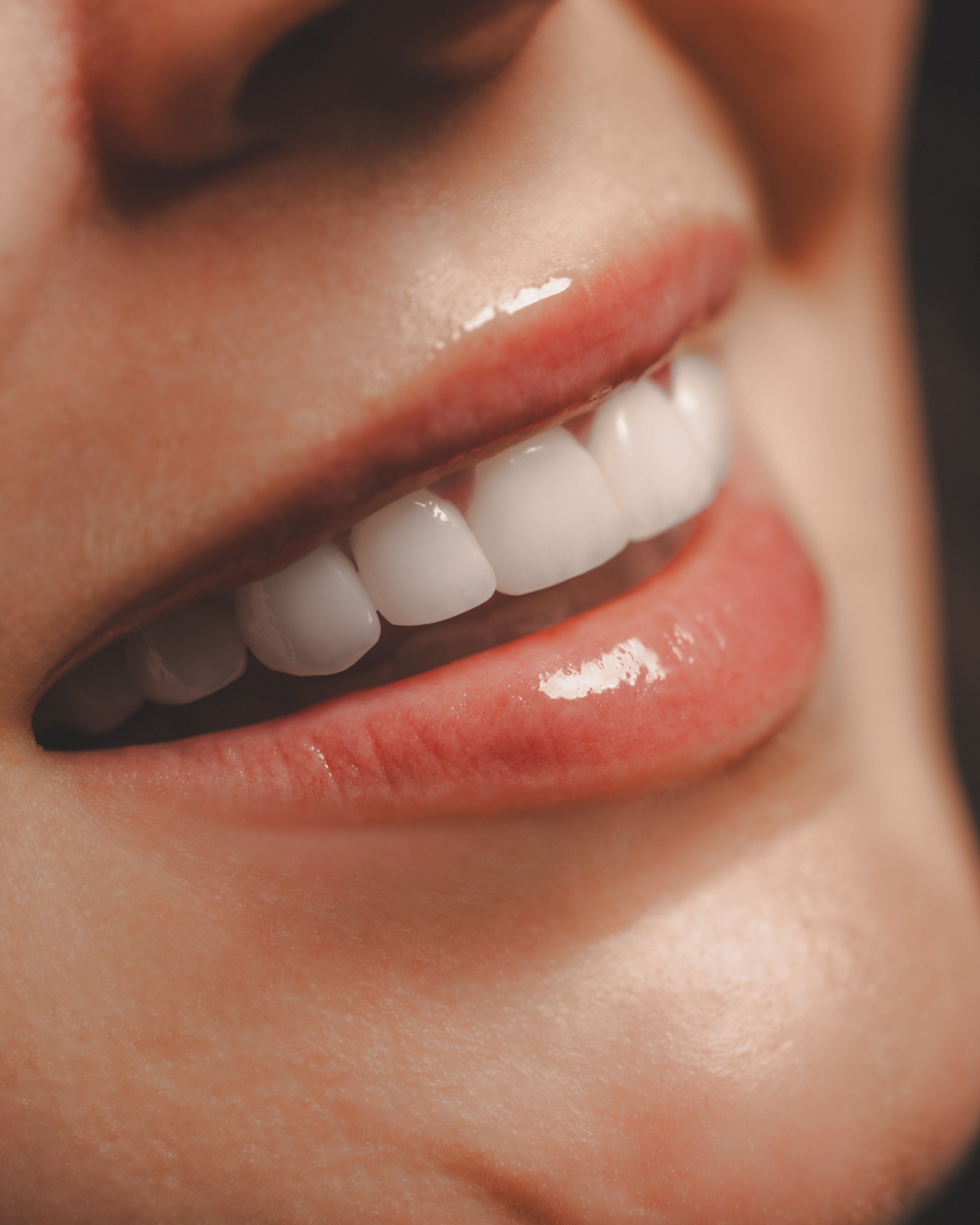 Patient Veneers Close Up