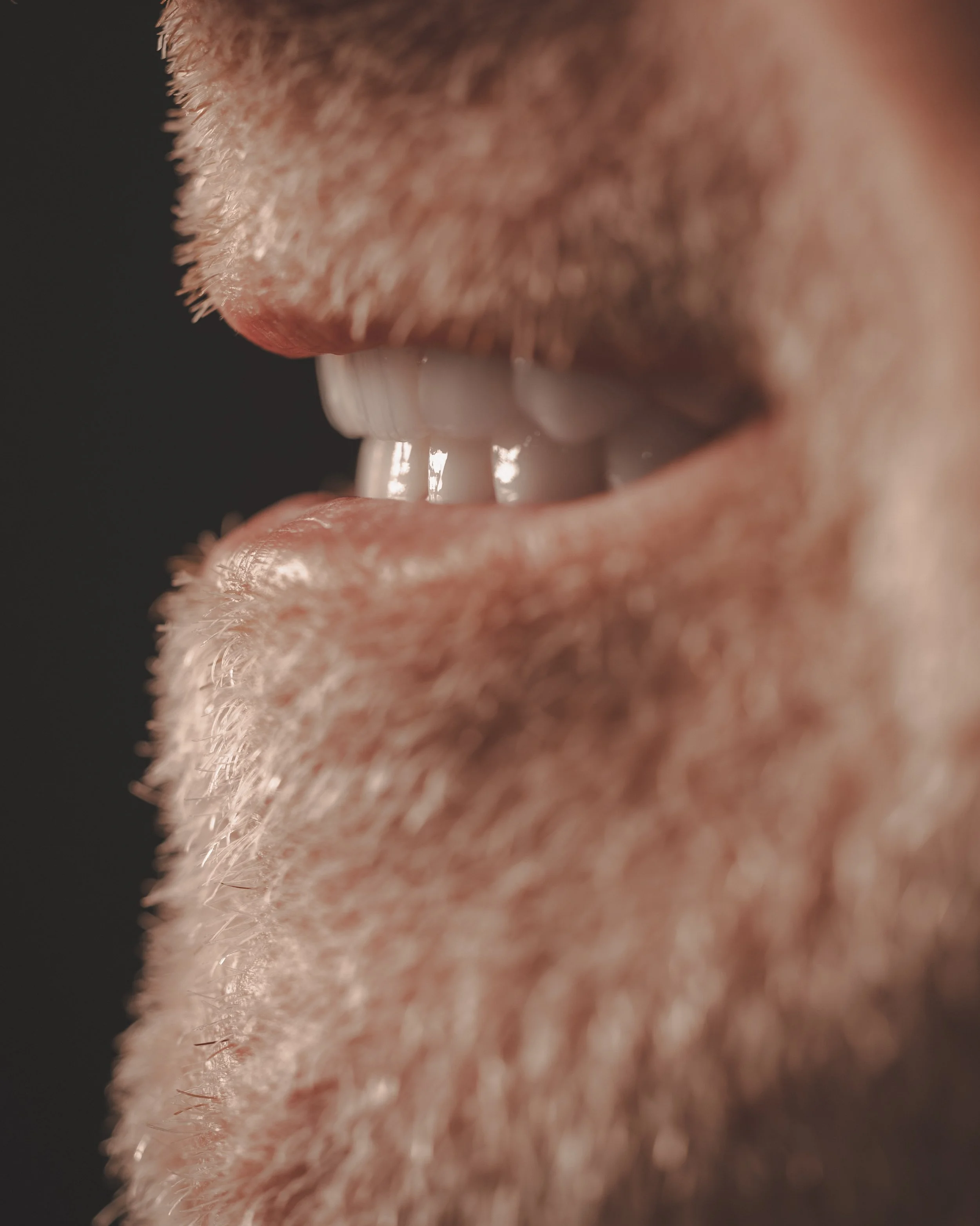Patient Full Arch Implants Close Up