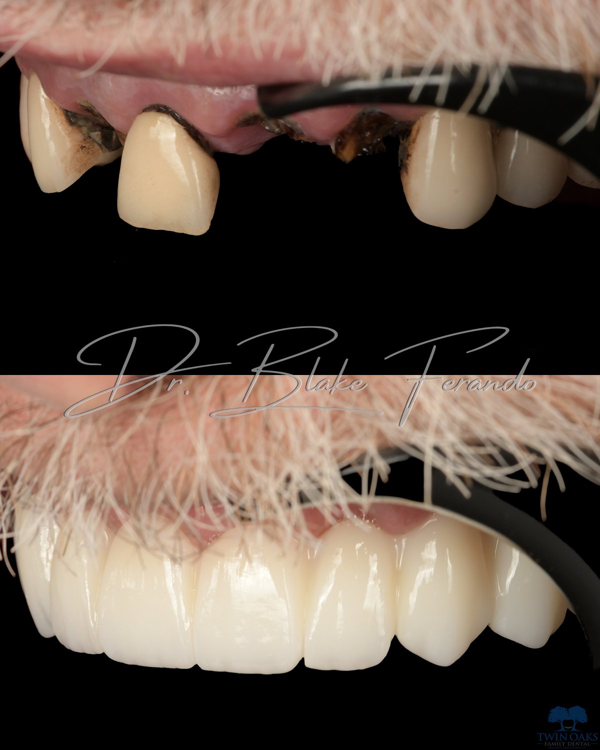Before & After Photo 6