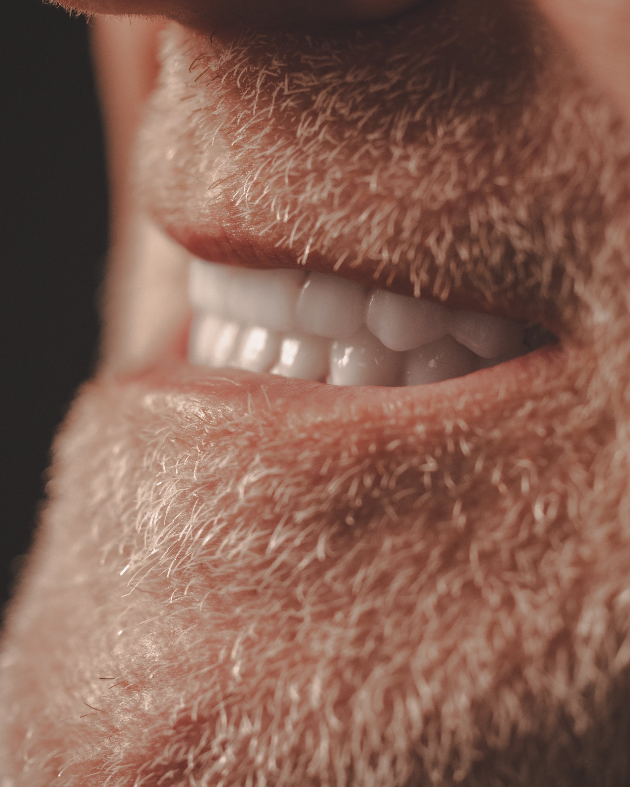 Patient Full Arch Implants Close Up