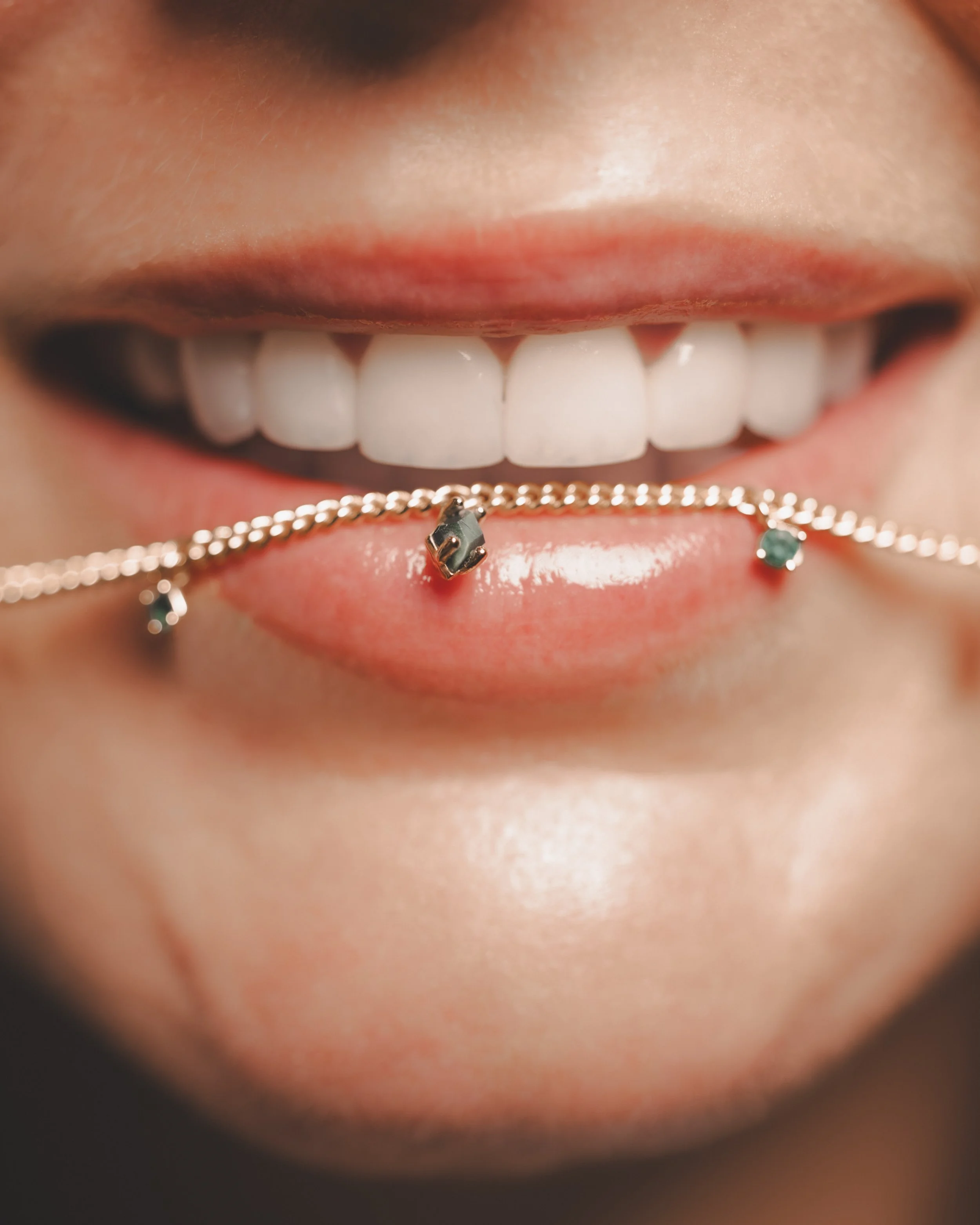 Patient Veneers Close Up