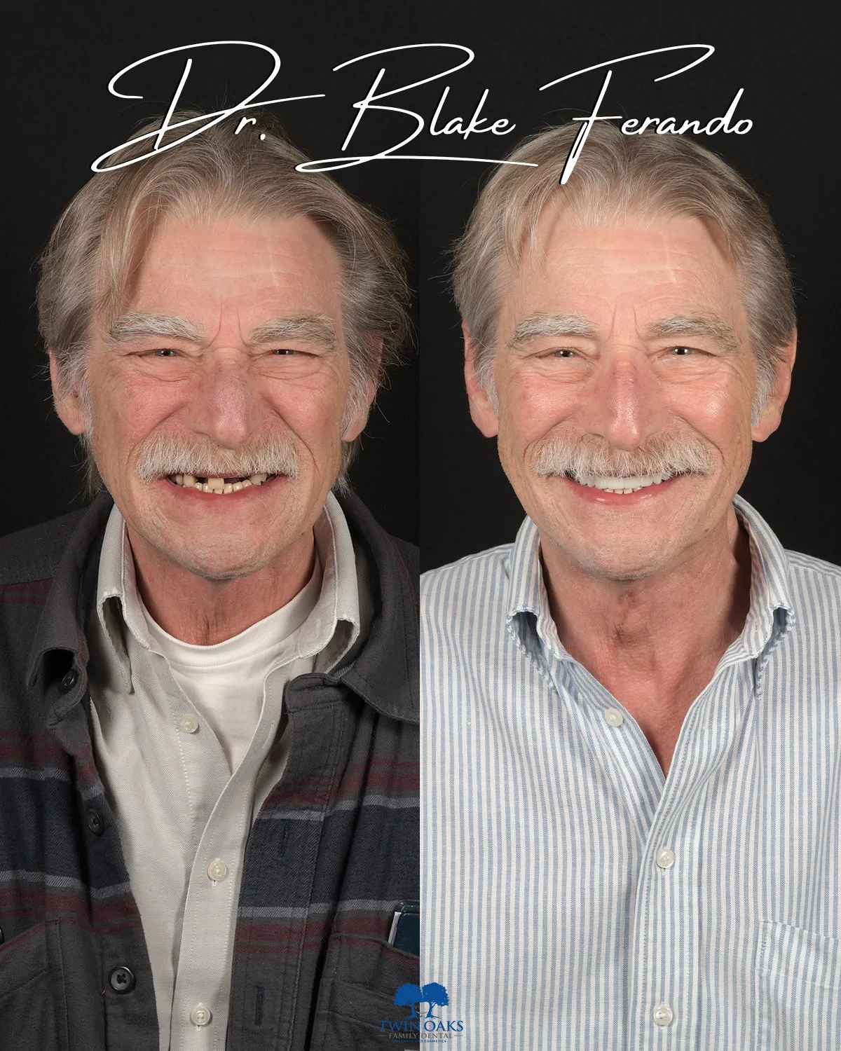 Before & After Photo 5